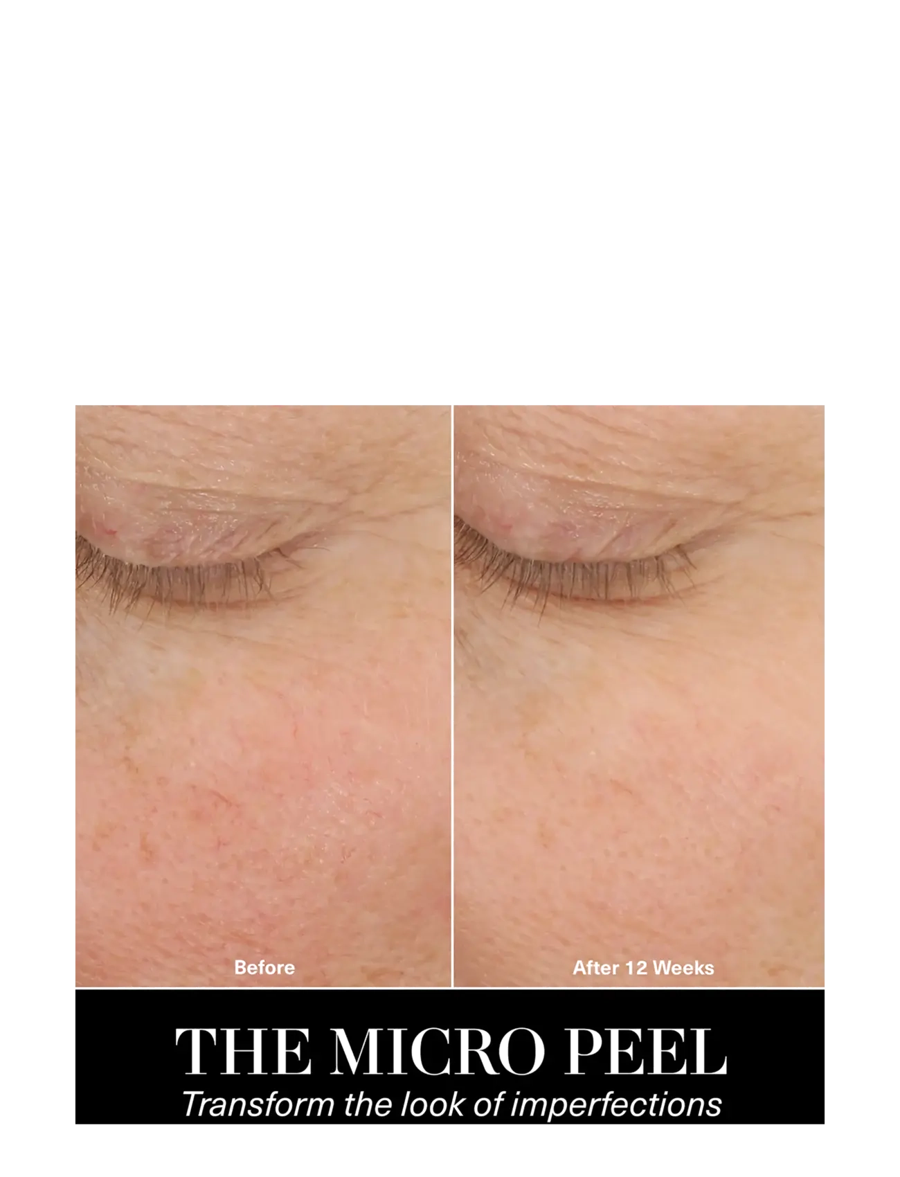 La Mer - The Micro Peel - ansiktspeeling - no colour - 3