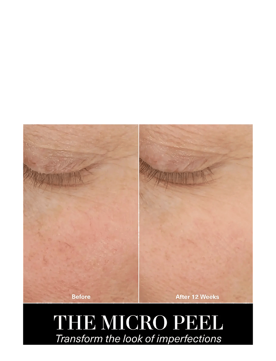 La Mer - The Micro Peel - peeling - ansikte - no colour - 3