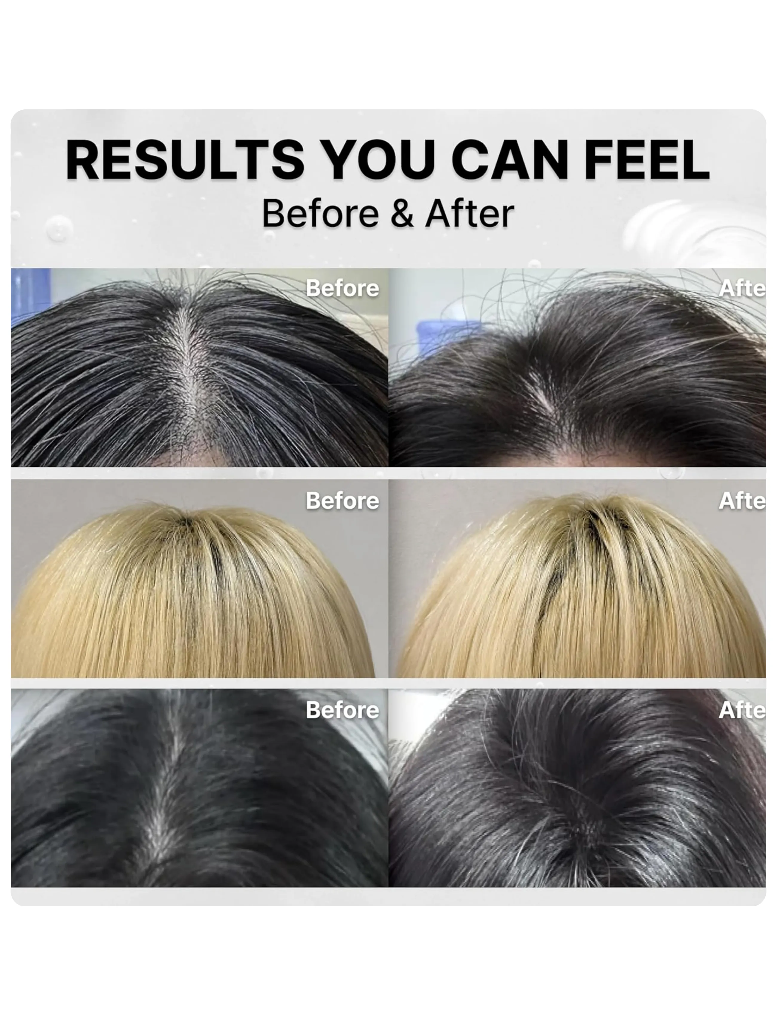 Lilyeve - Grow:Turn Exosome 3D Volume Shampoo - shampoo - clear - 0