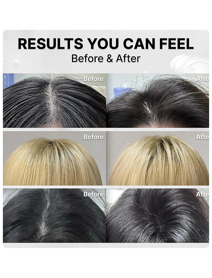 Lilyeve - Grow:Turn Exosome 3D Volume Shampoo - Šampoon - clear - 0