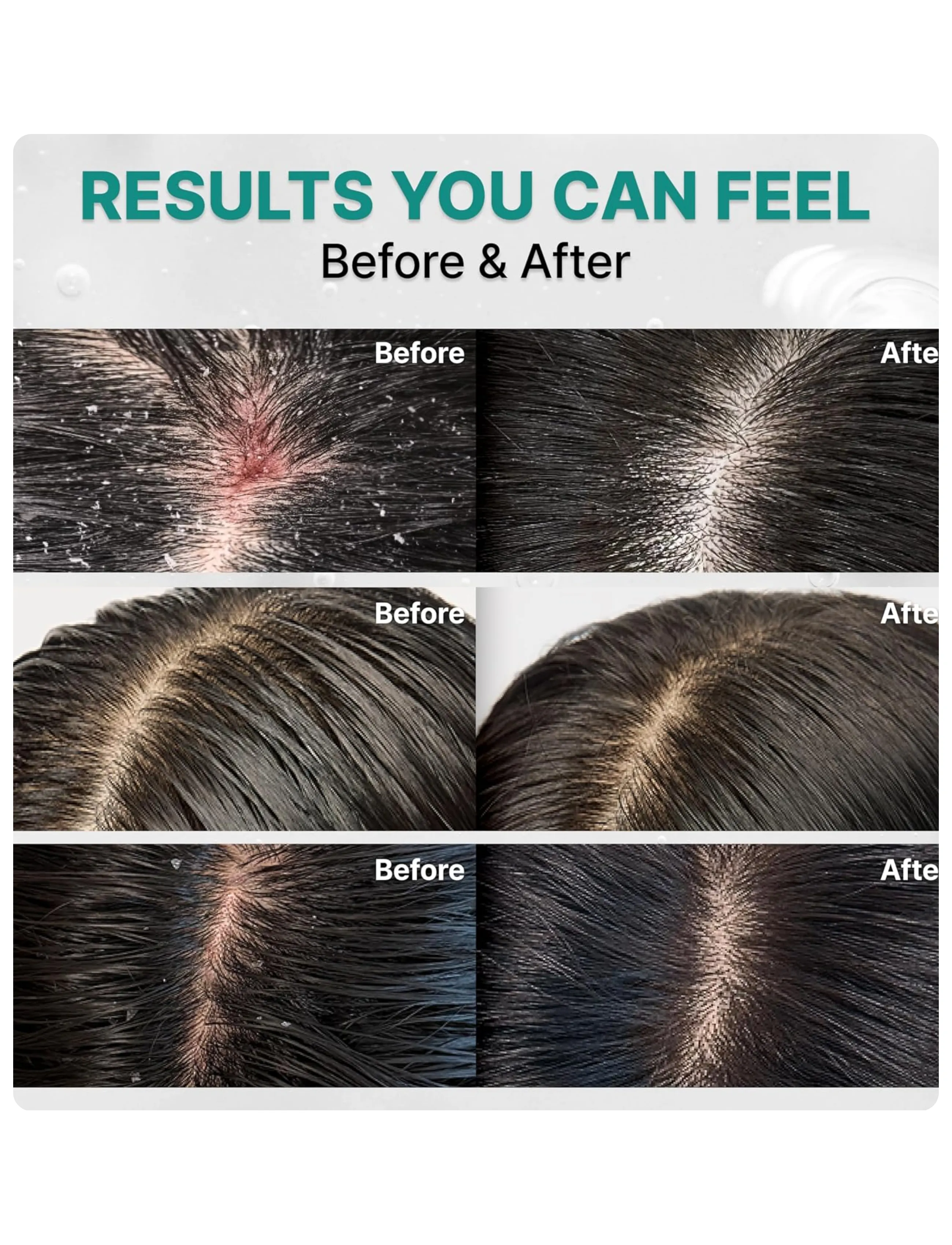Lilyeve - Scalp:Turn Cica PDRN Deep Clean Shampoo - shampoo - clear - 3
