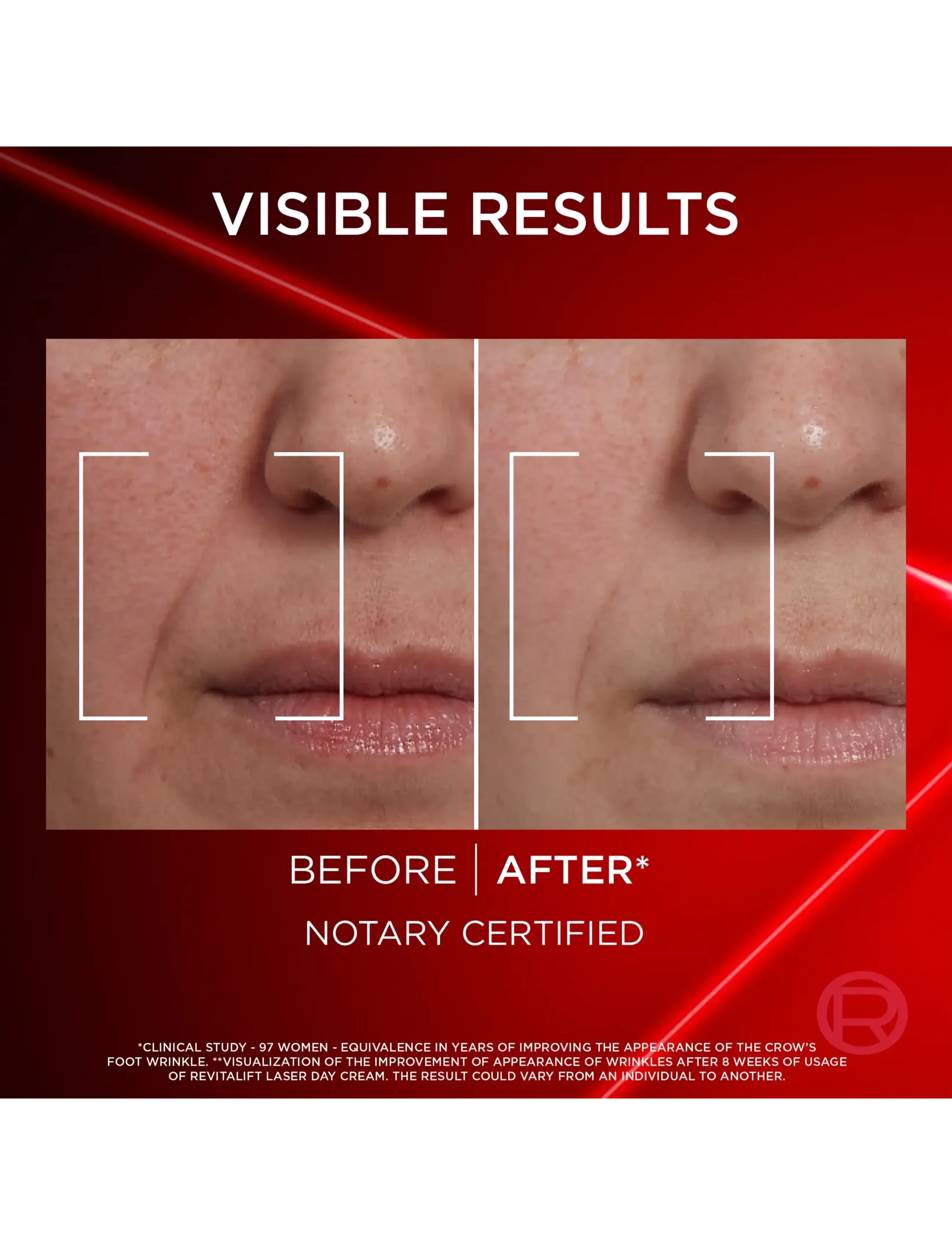 Revitalift Laser Day Cream 50 ml + Pure Retinol Night Serum 5