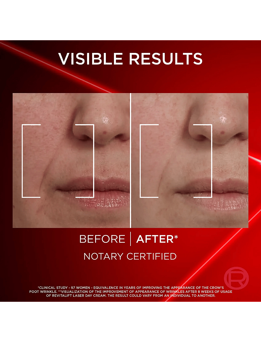 L'Oréal Paris - L'Oréal Paris Revitalift Laser Day Cream for normal skin 50 ml - päevakreemid - clear - 3
