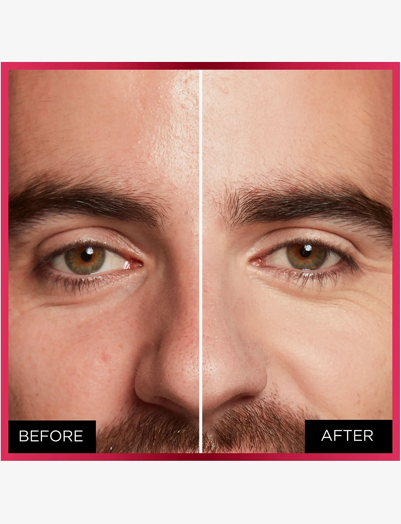 L'Oréal Paris - L'Oreal Paris Infaillible More Than Concealer 326 Vanilla - makeup - vanilla 326 - 1