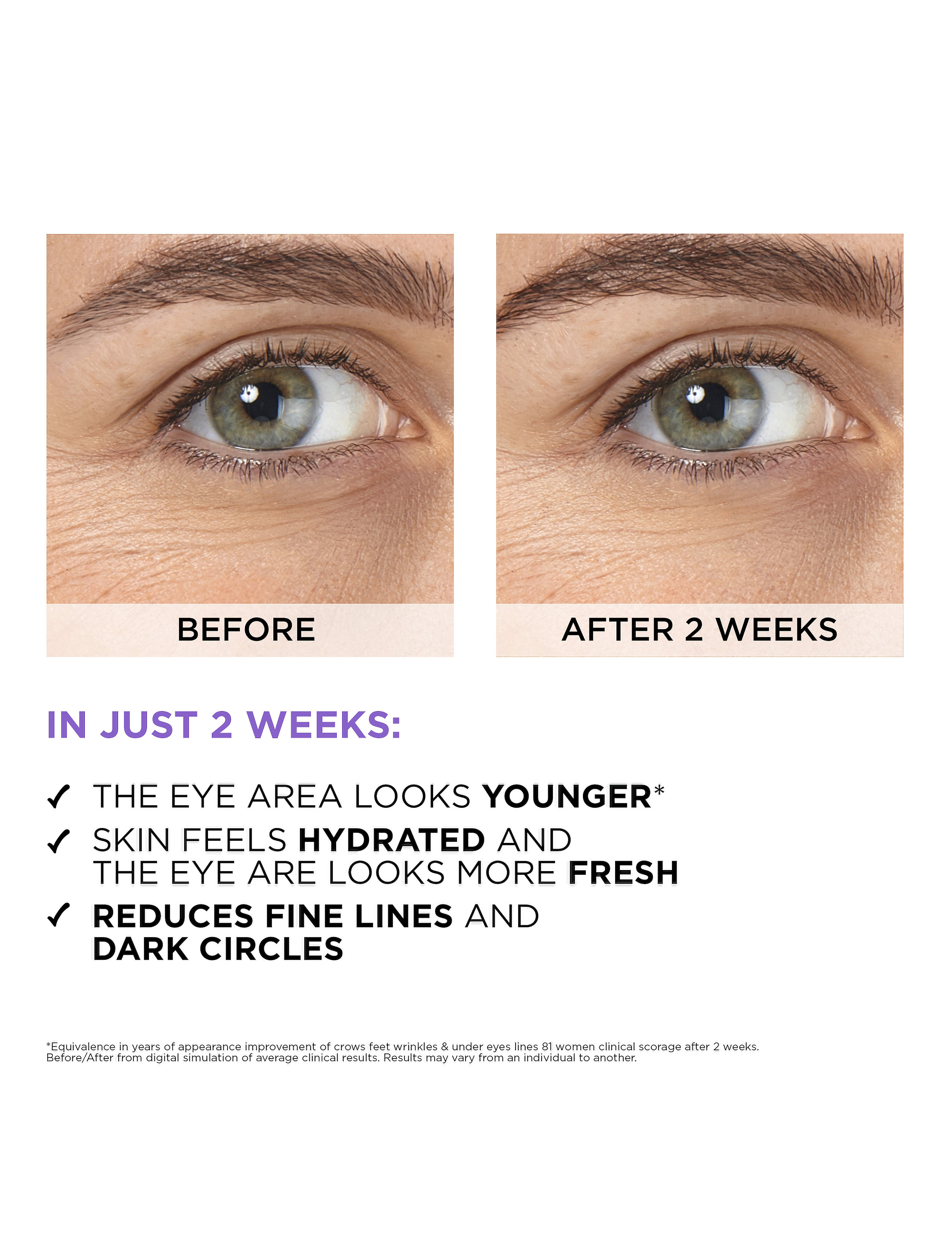 L'Oréal Paris - L'Oréal Paris Revitalift Filler 2,5% Hyaluronic Acid Eye Serum for normal skin 20 ml - Øjenserum - no colour - 5