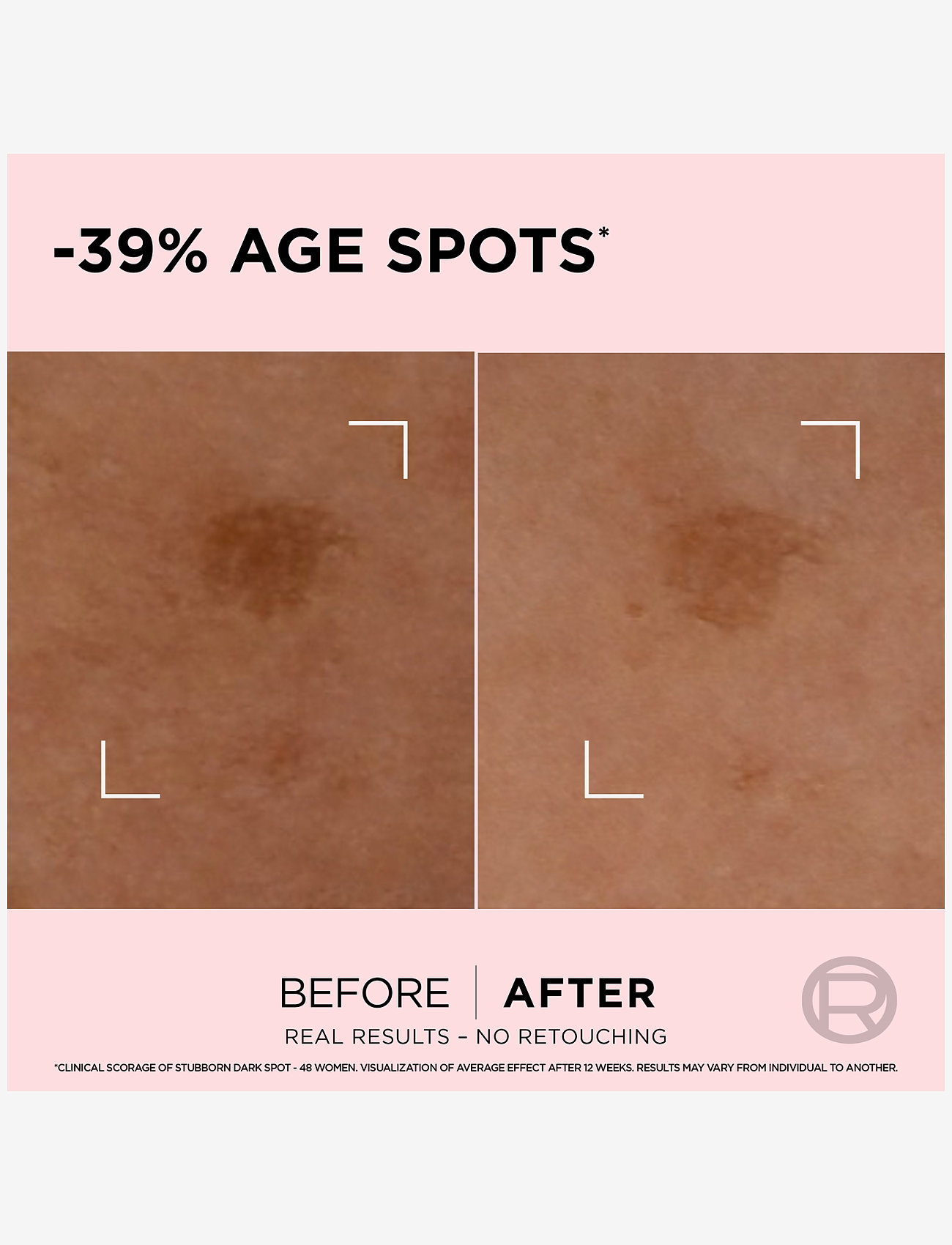 L'Oréal Paris - L'Oréal Paris, Age Perfect, Serum to reduce visibility of age spots, 30 ml - serum - golden age spot corrector - 4