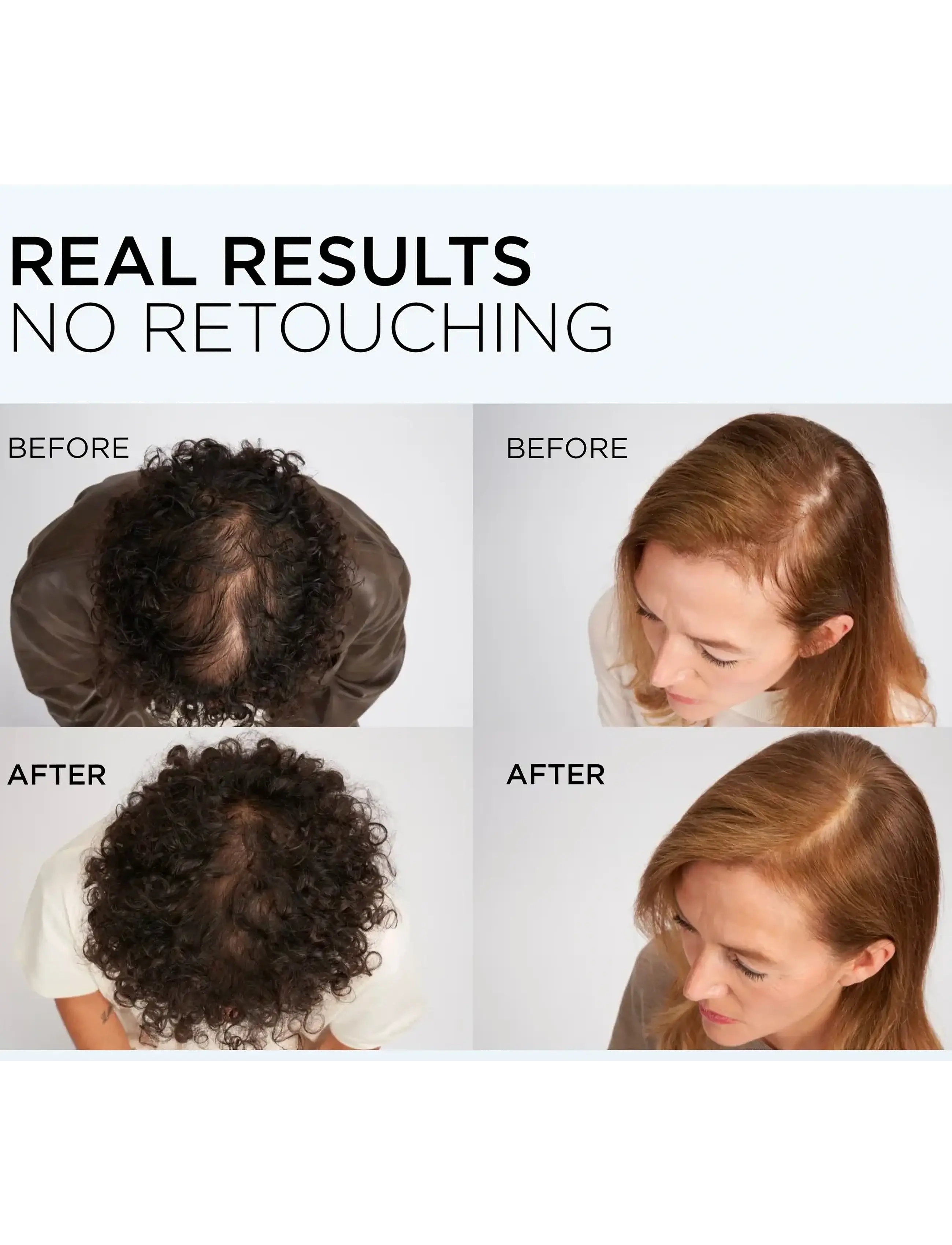 L'Oréal Paris - L'Oréal Paris Elvital Growth Booster Conditioner against hair loss 150 ml - hårpleje - clear - 4