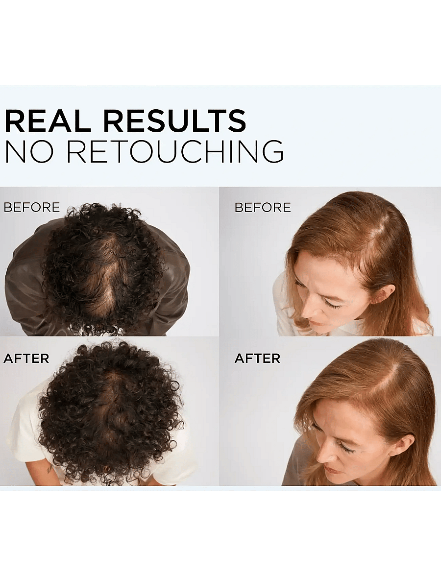 L'Oréal Paris - L'Oréal Paris Elvital Growth Booster Conditioner against hair loss 150 ml - hårpleje - clear - 4