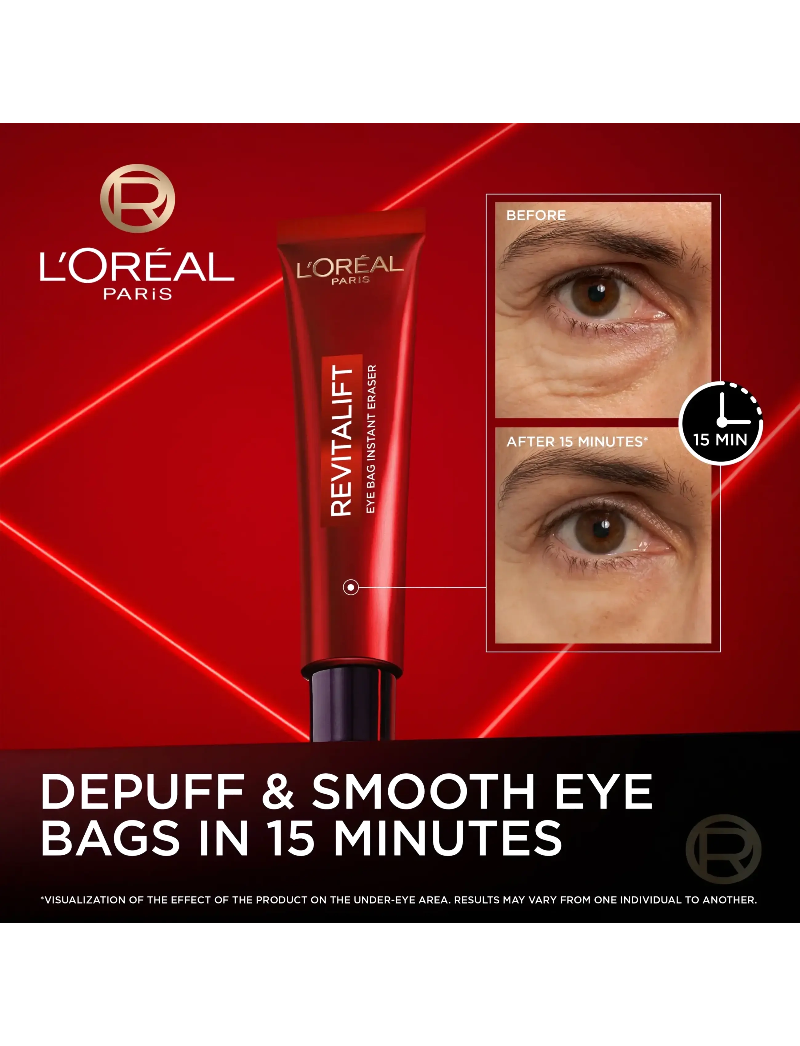L'Oréal Paris - L'Oréal Paris Revitalift Laser Eye Bag Eraser - Øjencremer - clear - 1