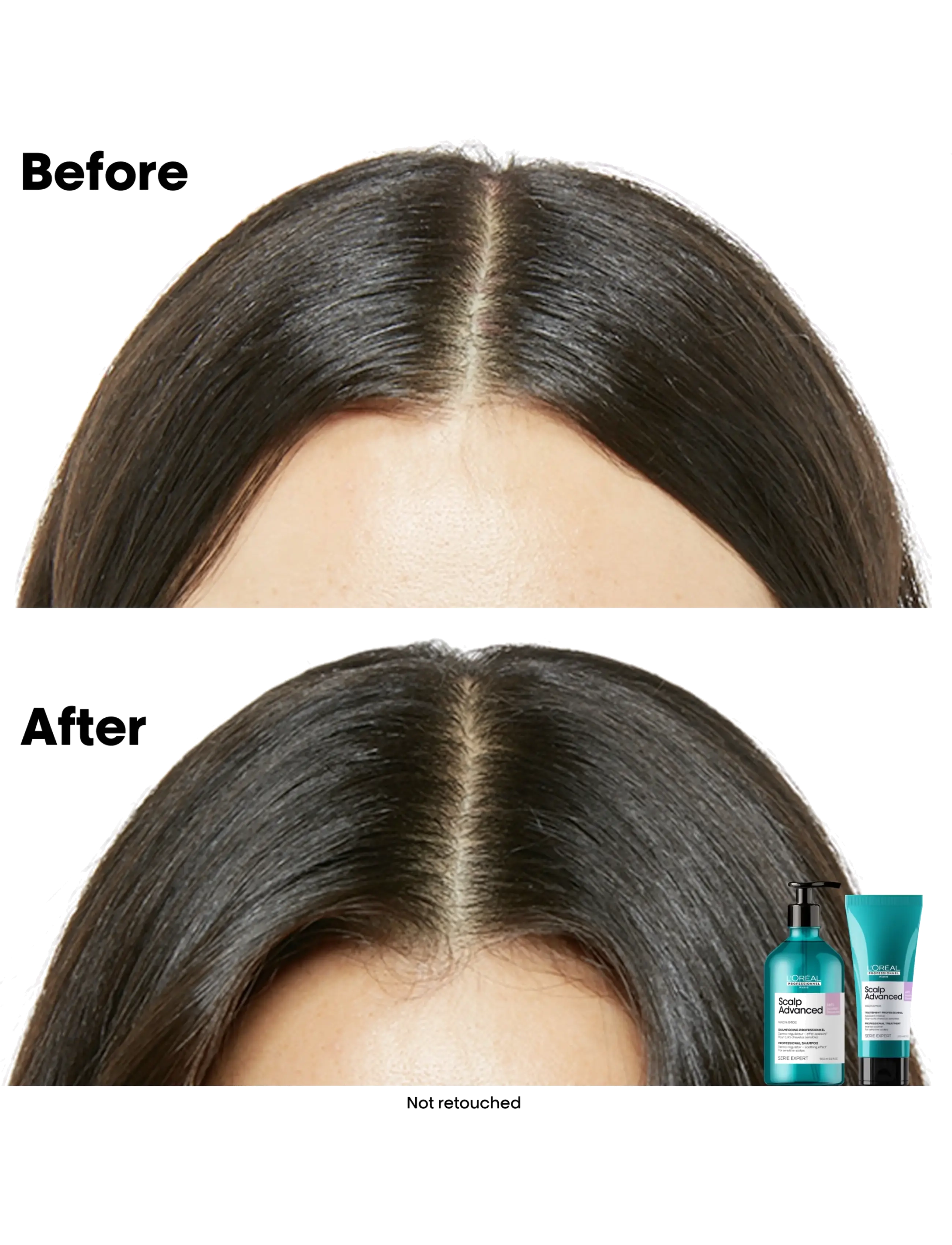 L'Oréal Professionnel - L'Oréal Professionnel Scalp Advanced Anti-Discomfort Shampoo 500ml - shampoo - no colour - 2