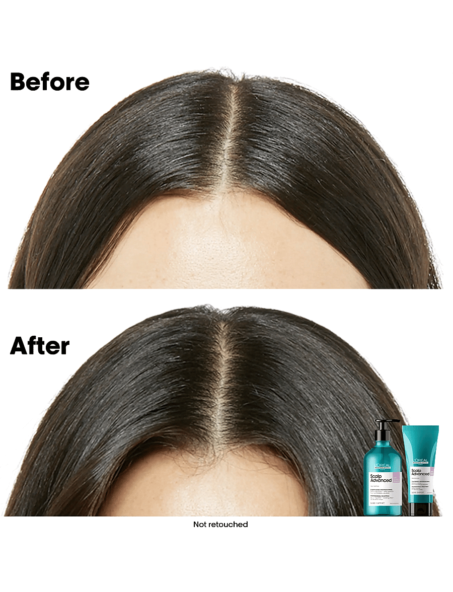 L'Oréal Professionnel - L'Oréal Professionnel Scalp Advanced Anti-Discomfort Shampoo 500ml - shampoo - no colour - 2