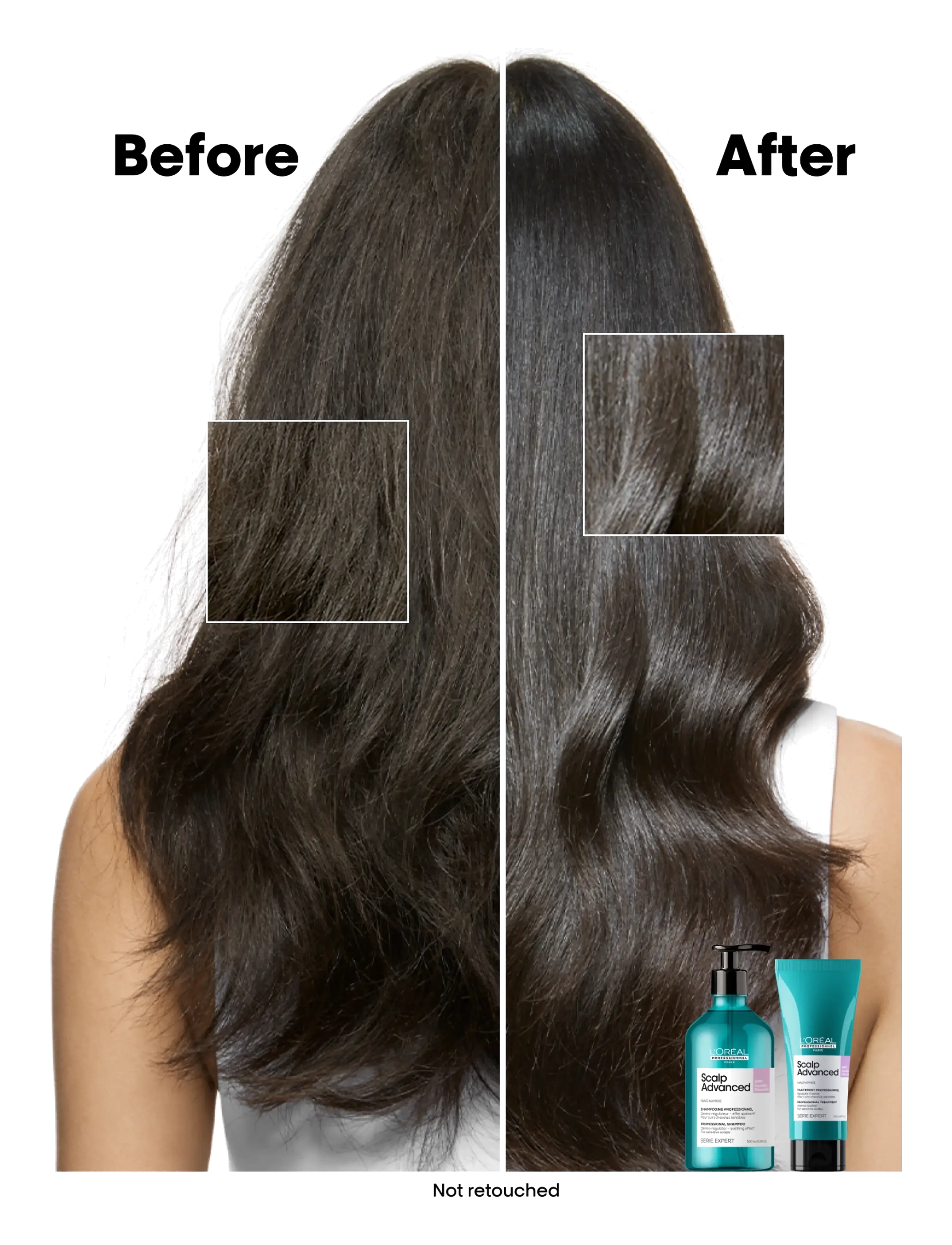 L'Oréal Professionnel - L'Oréal Professionnel Scalp Advanced Anti-Discomfort Shampoo 500ml - shampoo - no colour - 4