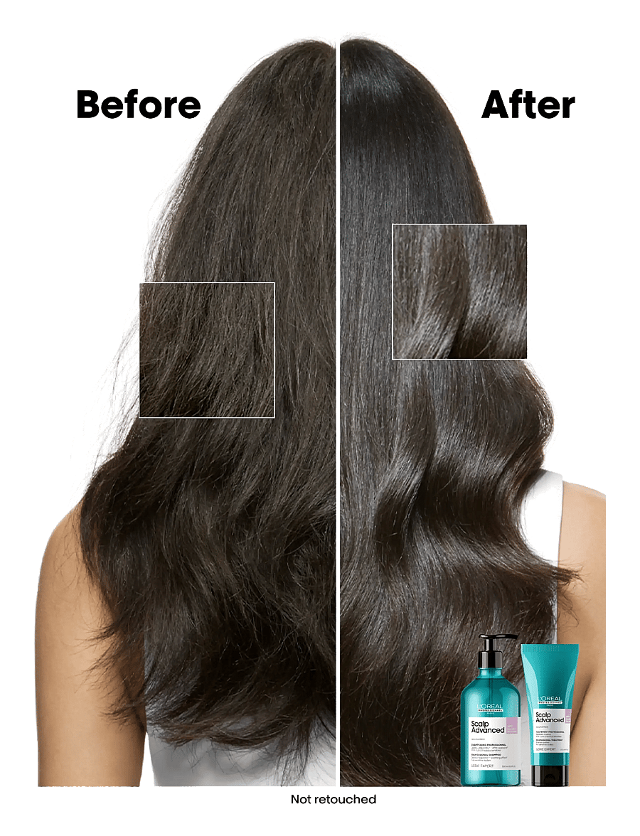 L'Oréal Professionnel - L'Oréal Professionnel Scalp Advanced Anti-Discomfort Treatment 200ml - behandling - no colour - 3