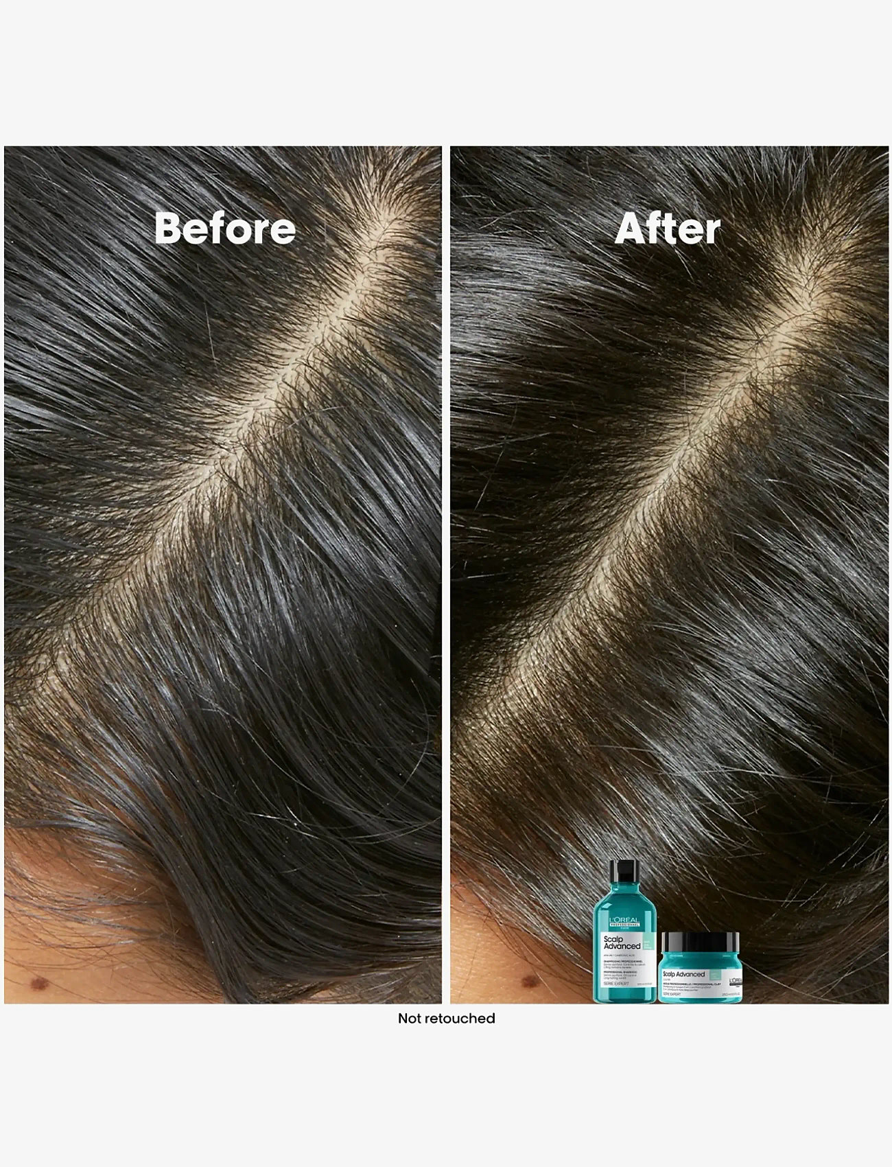 L'Oréal Professionnel - L'Oréal Professionnel Scalp Advanced Anti-Oiliness Shampoo 300ml - shampoo - no colour - 1