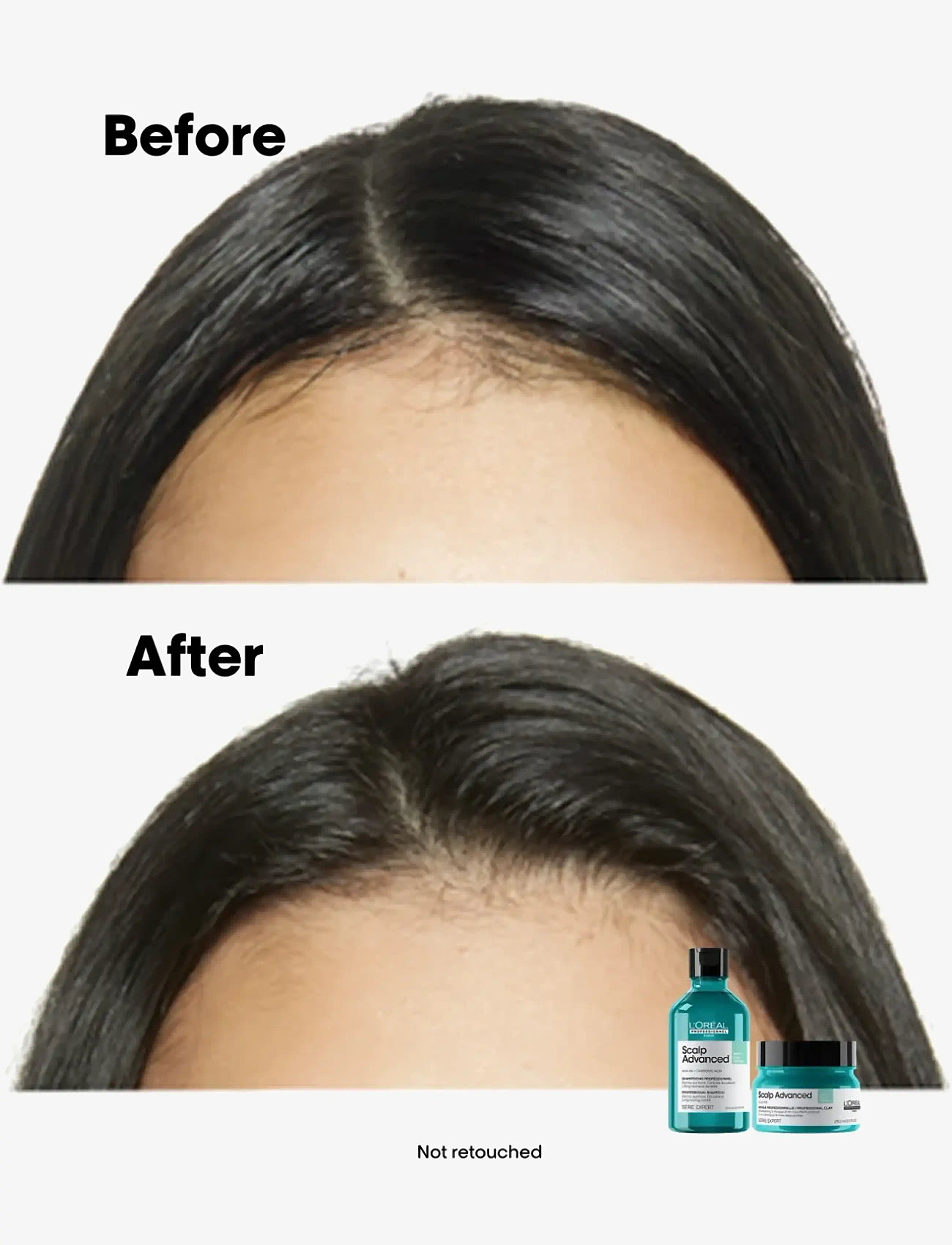 L'Oréal Professionnel - L'Oréal Professionnel Scalp Advanced Anti-Oiliness Shampoo 300ml - shampoo - no colour - 2