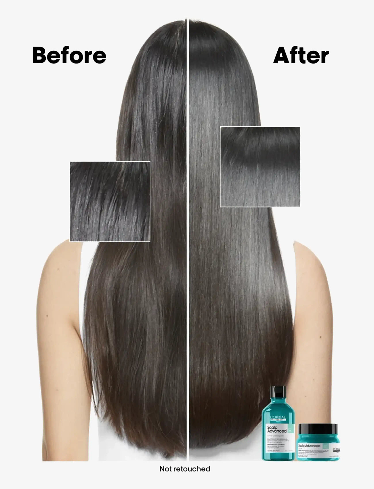 L'Oréal Professionnel - L'Oréal Professionnel Scalp Advanced Anti-Oiliness Shampoo 300ml - shampoo - no colour - 3