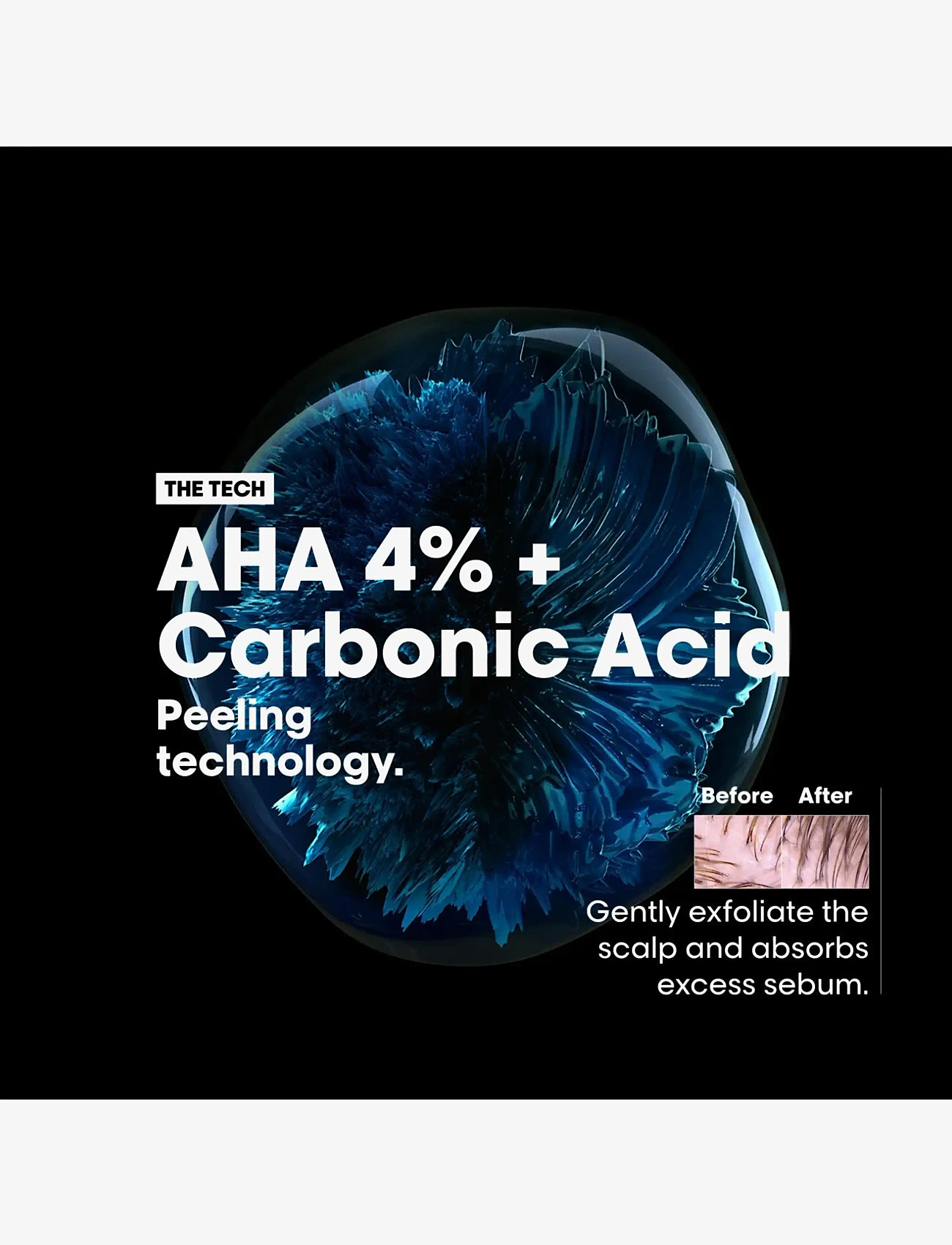 L'Oréal Professionnel - L'Oréal Professionnel Scalp Advanced Anti-Oiliness Shampoo 300ml - shampoo - no colour - 5