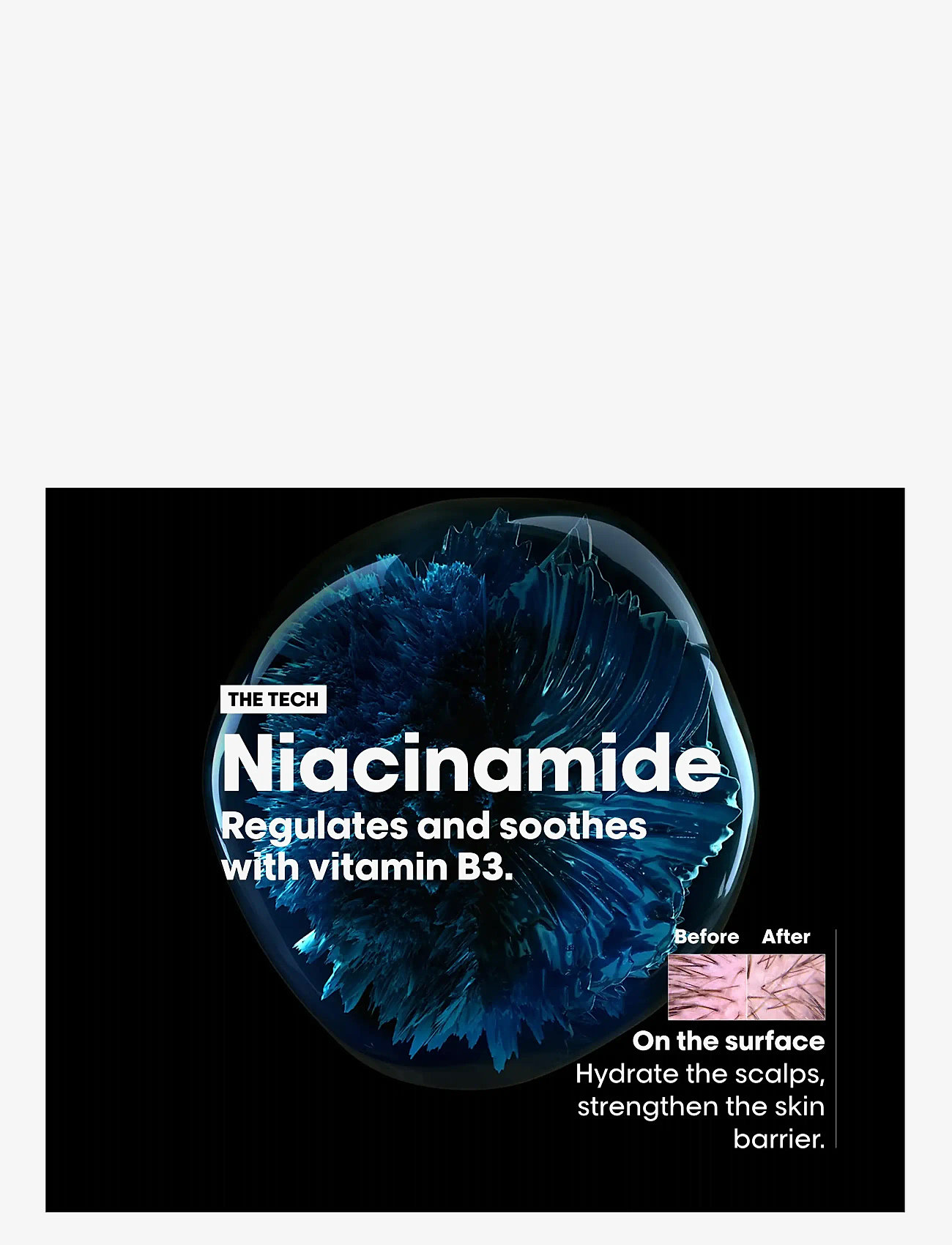 L'Oréal Professionnel - L'Oréal Professionnel Scalp Advanced Anti-Dandruff Shampoo 300ml - shampoo - no colour - 4