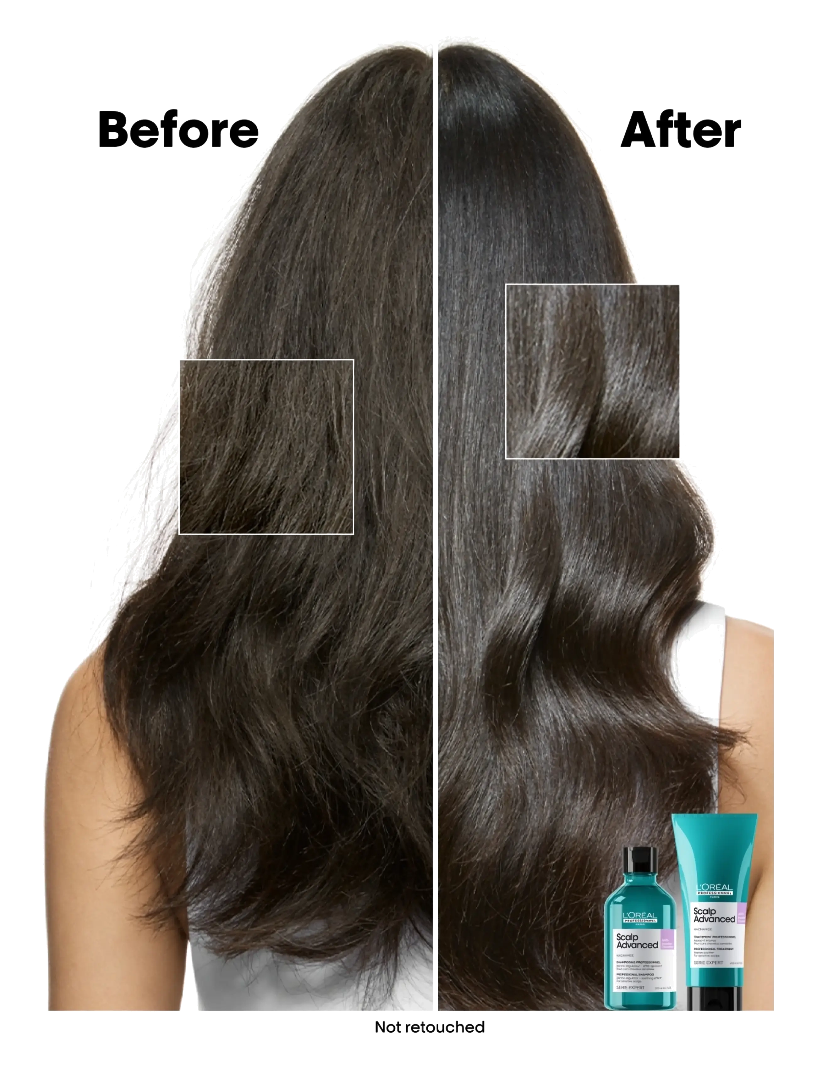 L'Oréal Professionnel - L'Oréal Professionnel Scalp Advanced Anti-Discomfort Shampoo 500ml Refill - refill til hårpleje - clear - 2