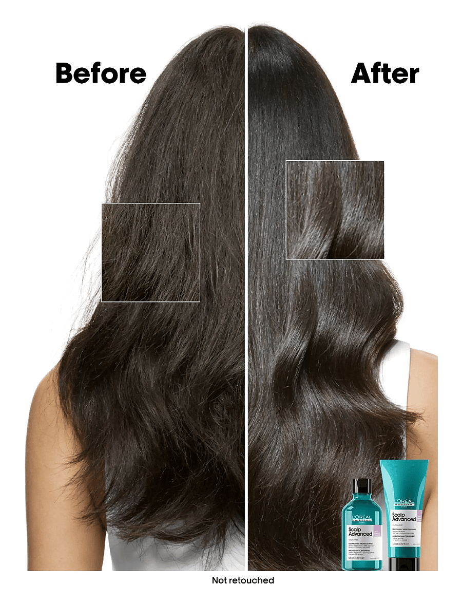 L'Oréal Professionnel - L'Oréal Professionnel Scalp Advanced Anti-Discomfort Shampoo 500ml Refill - hårvård refill - clear - 2