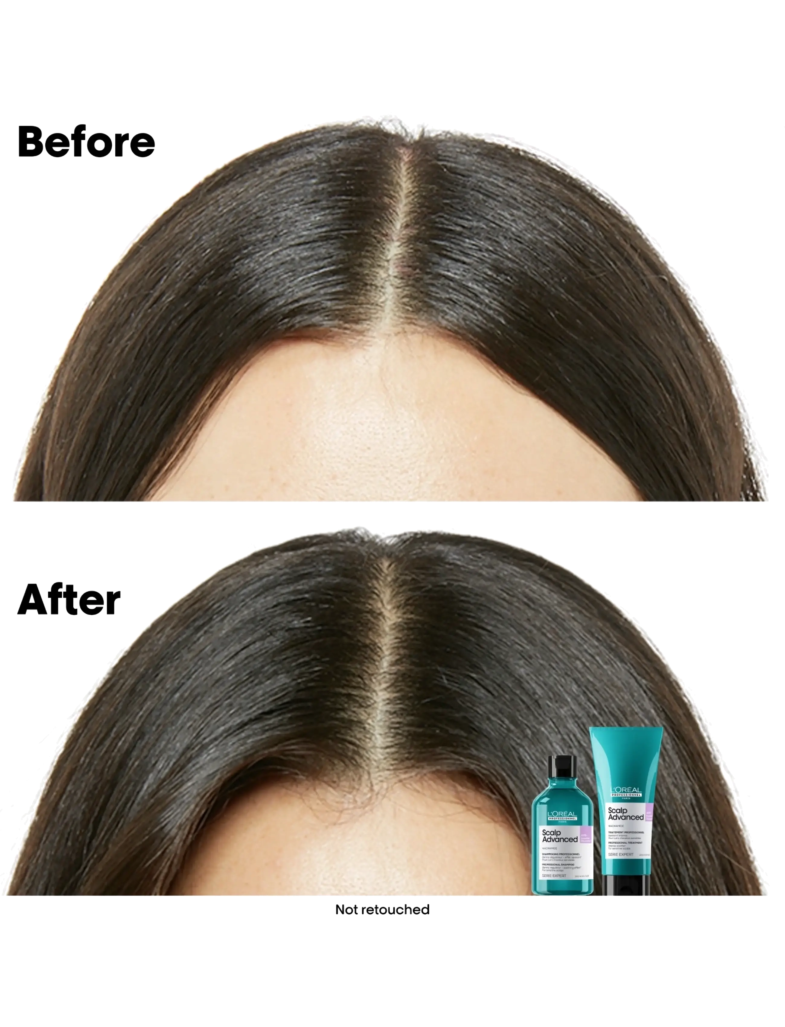 L'Oréal Professionnel - L'Oréal Professionnel Scalp Advanced Anti-Discomfort Shampoo 500ml Refill - refill til hårpleje - clear - 3