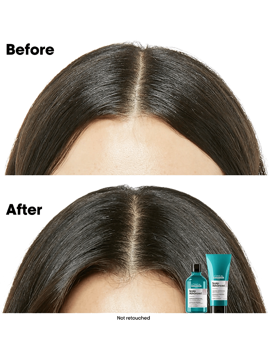L'Oréal Professionnel - L'Oréal Professionnel Scalp Advanced Anti-Discomfort Shampoo 500ml Refill - hårvård refill - clear - 3