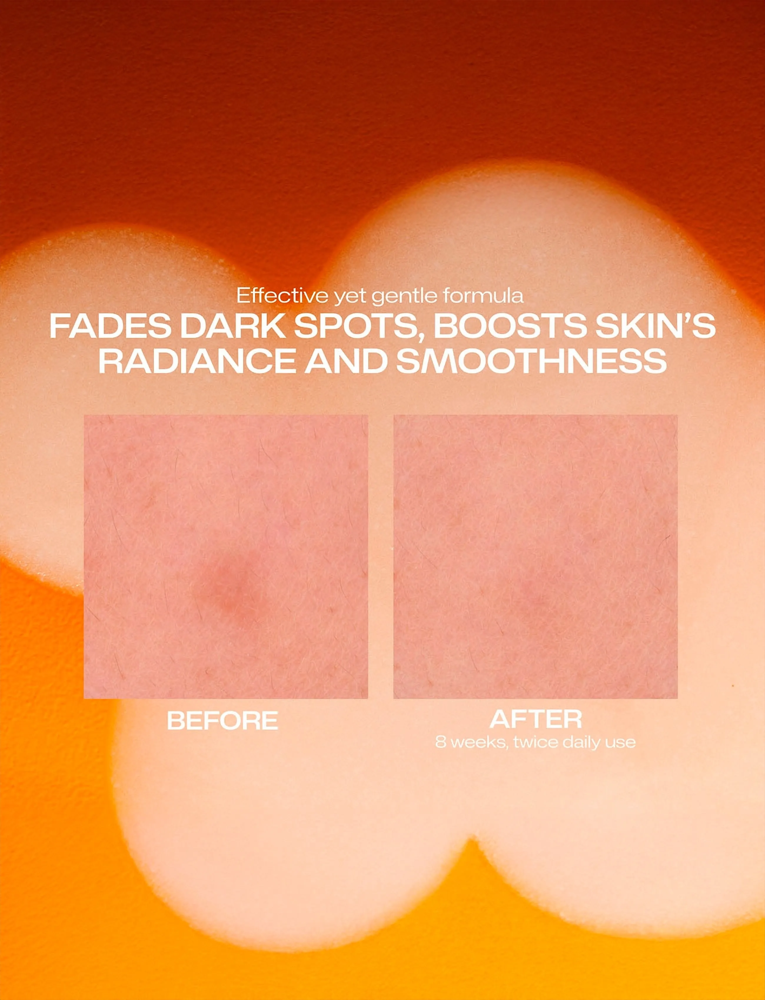 LUMENE Nordic-C Dark Spot Serum, 30 ml, Nude, Ansigt > Serum, Dame