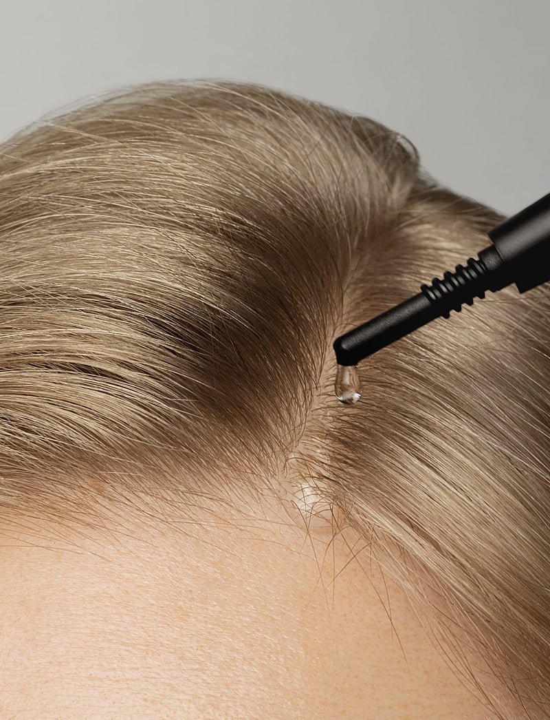 MÁDARA - SCALP Peel Serum - juuksehooldused - clear - 3