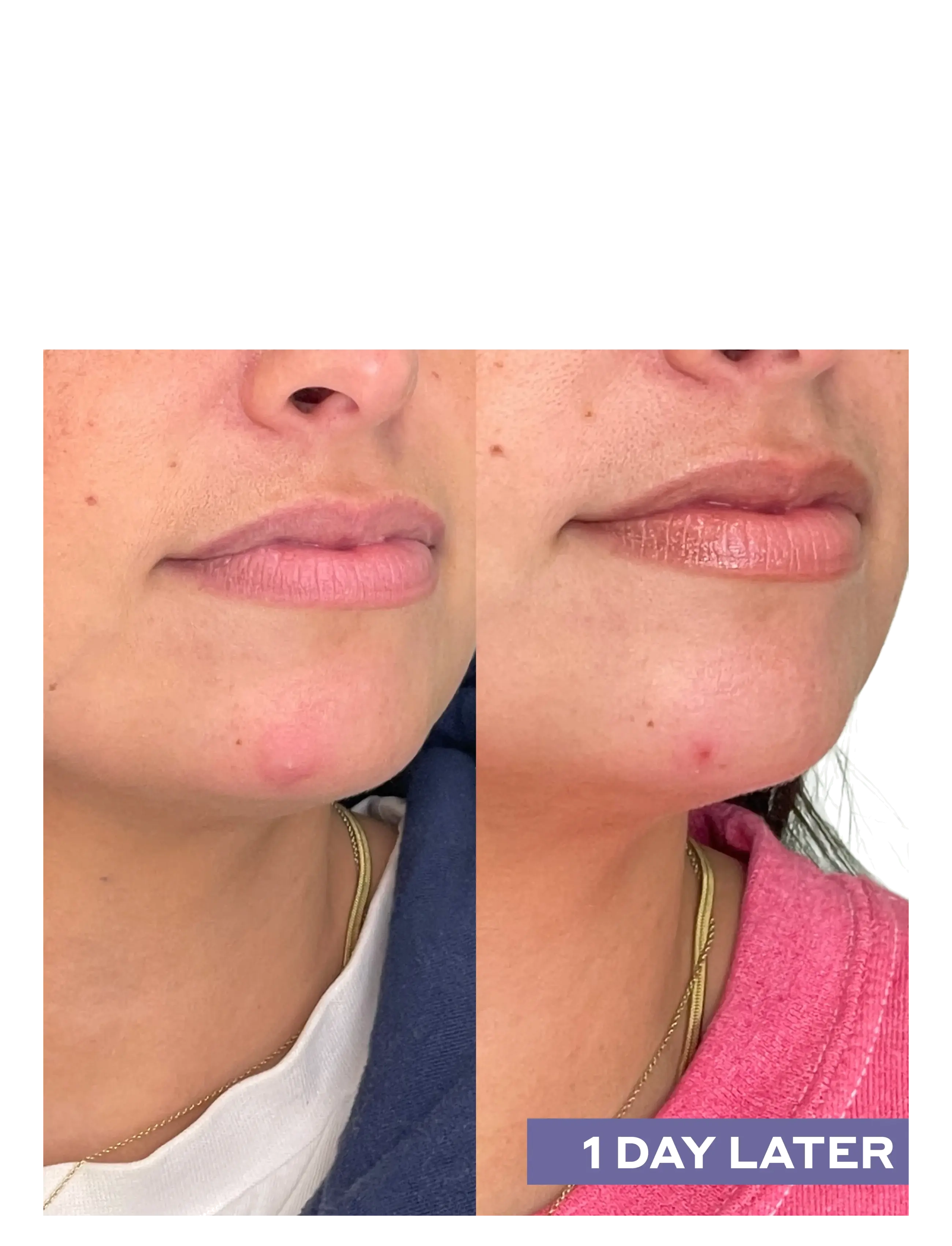 Mario Badescu - Repairing Facial Spray W/ Hypochlorous Acid - eksfolierende tonere - no color - 4