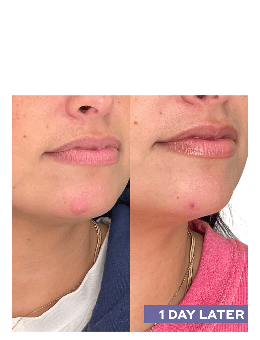 Mario Badescu - Repairing Facial Spray W/ Hypochlorous Acid - hreinsandi tóner - no color - 4