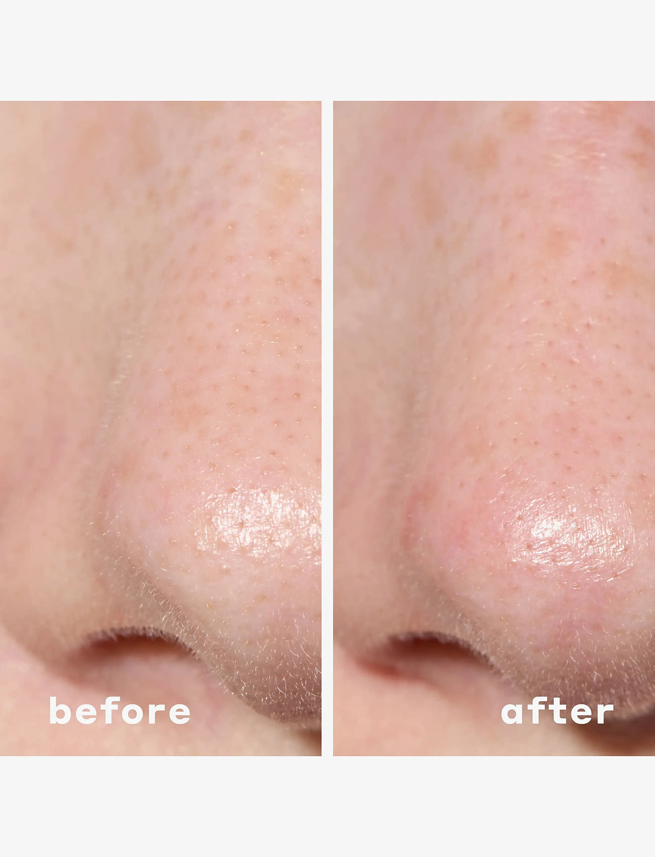 Mario Badescu - 2-In-1 Deep Cleansing Pore Strip - rengöringsservetter - no color - 4