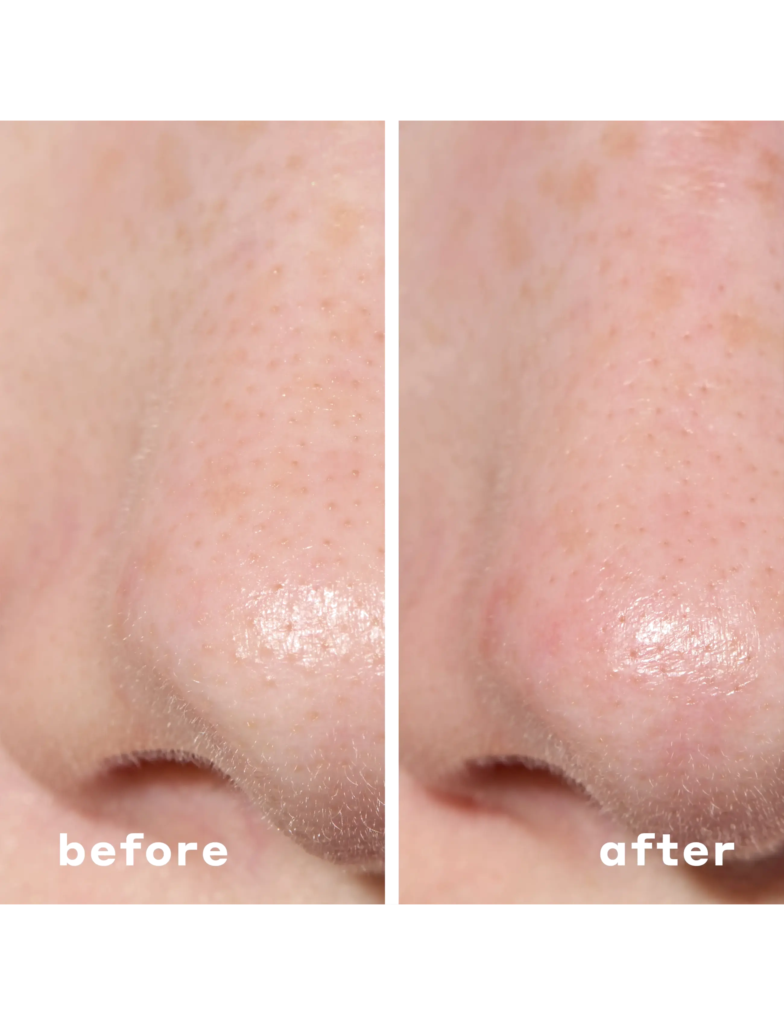 Mario Badescu - 2-In-1 Deep Cleansing Pore Strip - kasvonpuhdistusliinat - no color - 4