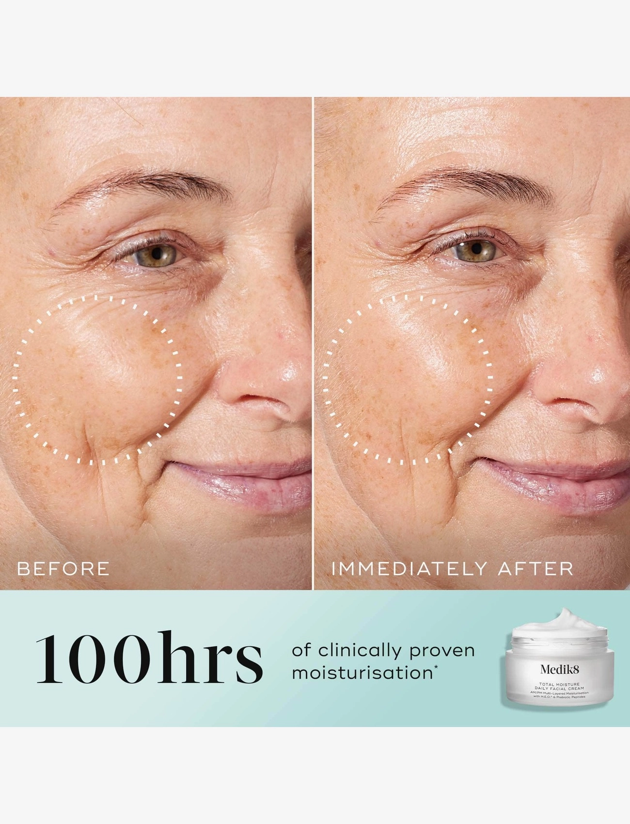 Total Moisture Daily Facial Cream 4