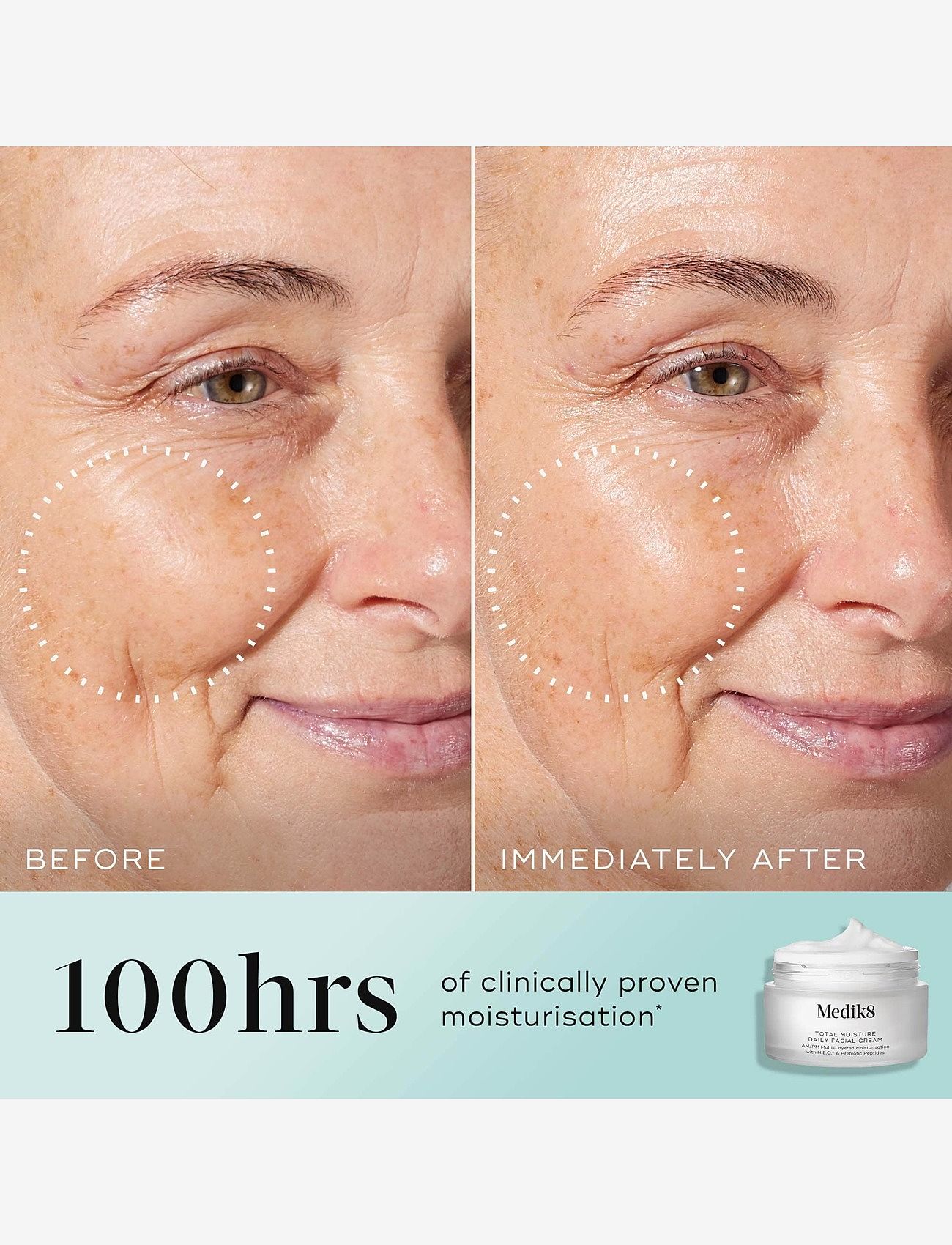 Medik8 - Total Moisture Daily Facial Cream - sommerens hudpleje - clear - 2