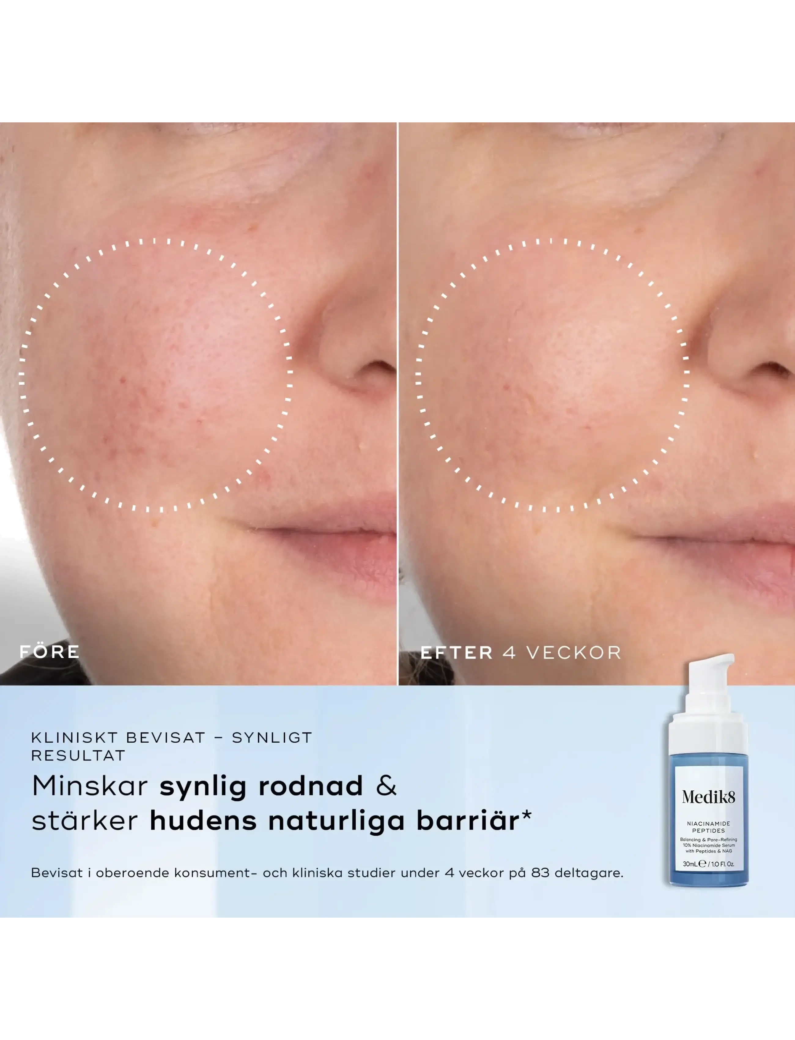 Medik8 - Niacinamide Peptides - seerumid ja õlid - clear - 4