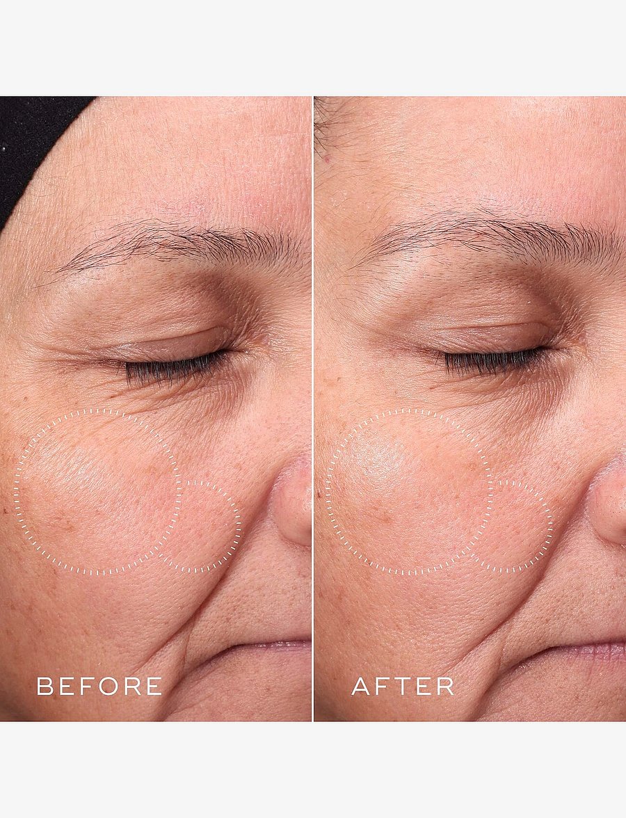 Medik8 - Press & Glow - sommerens hudpleje - clear - 4