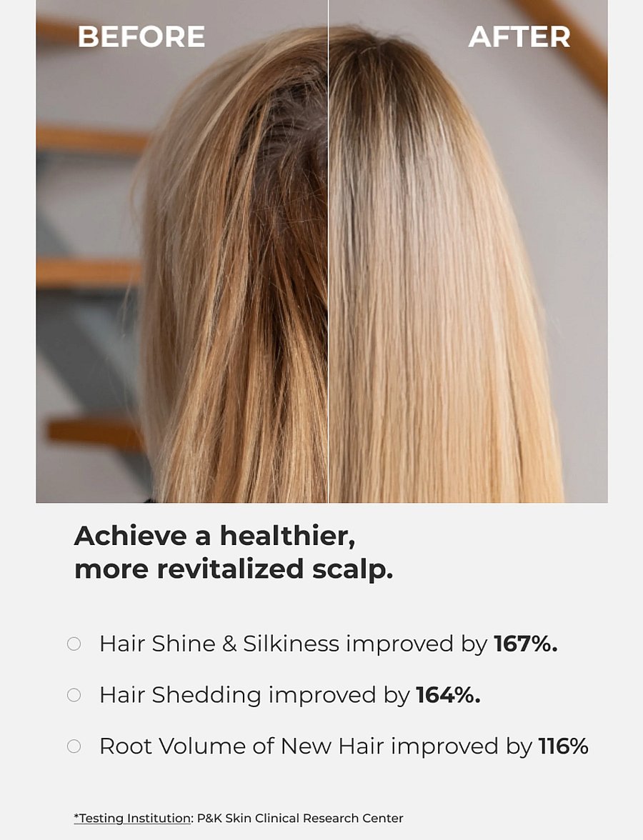 MOEV - Annurcatin Shampoo - Šampoon - clear - 2