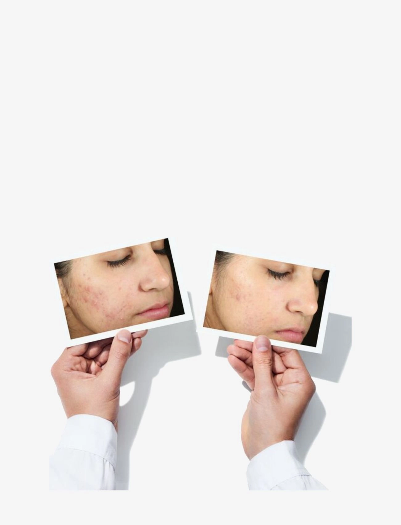 Murad - Invisiscar Blemish Scar Treatment - hudvård - no colour - 3