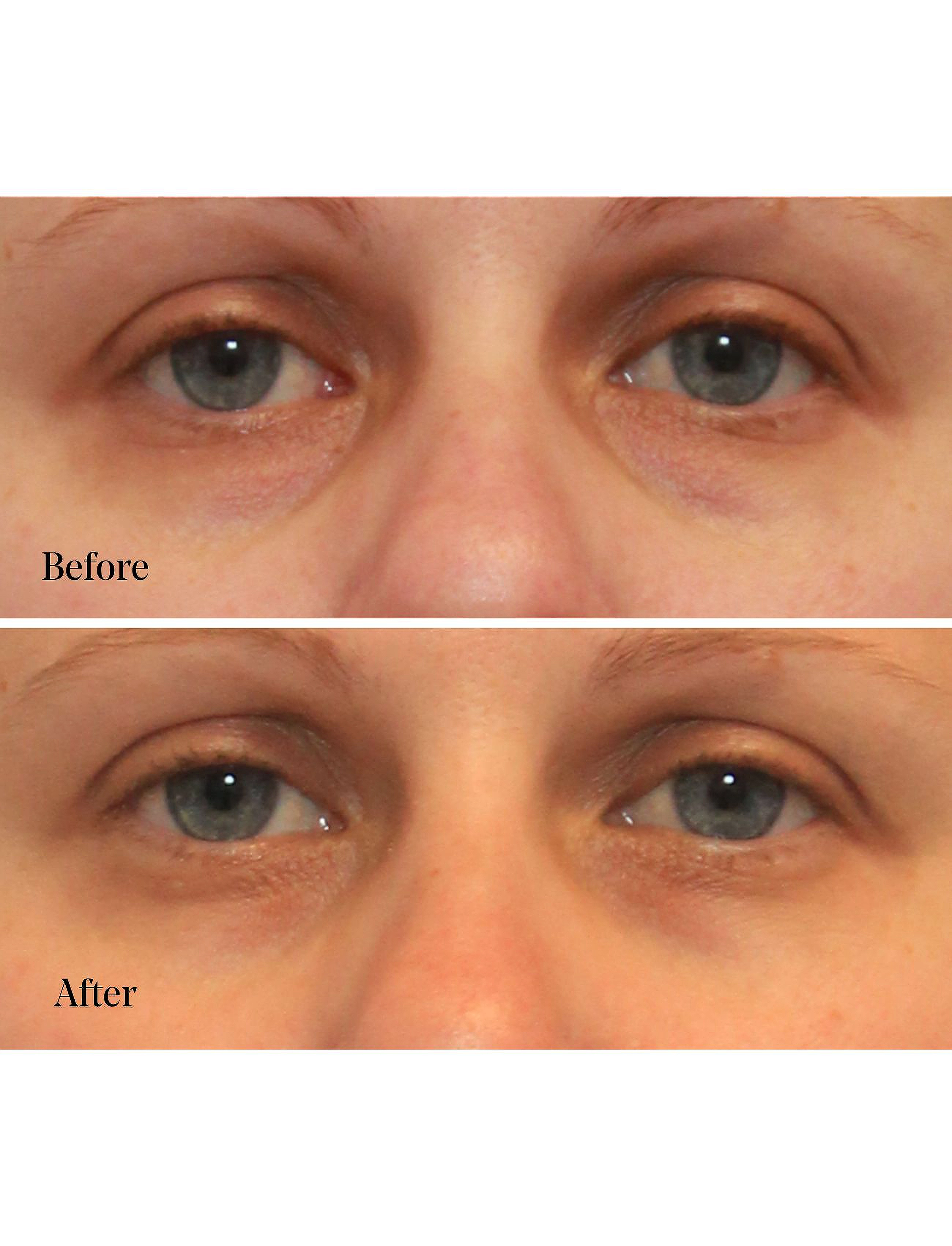 Murad - Vita-C Eyes Dark Circle Corrector - Øjencremer - orance - 2