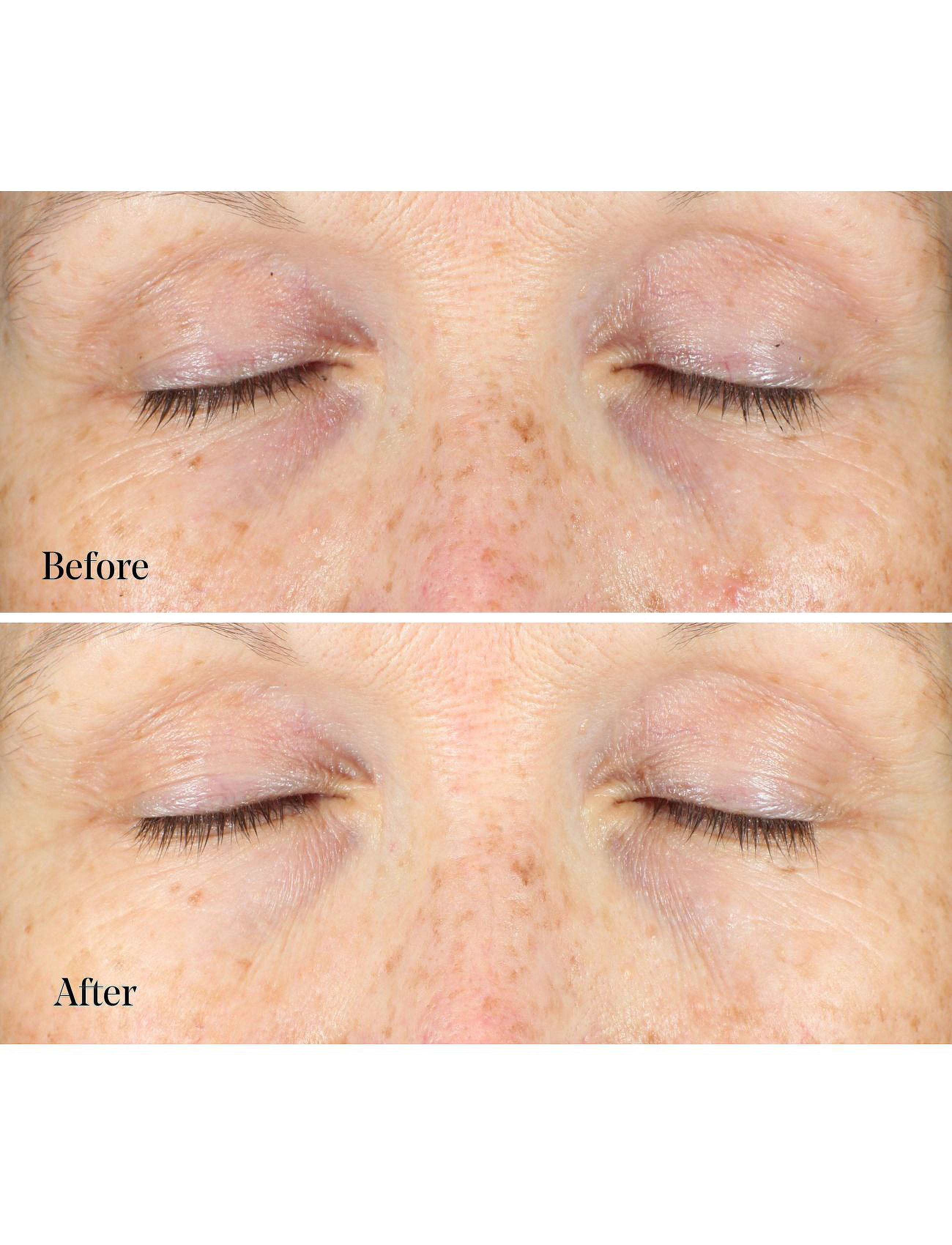 Murad - Vita-C Eyes Dark Circle Corrector - Øjencremer - orance - 3