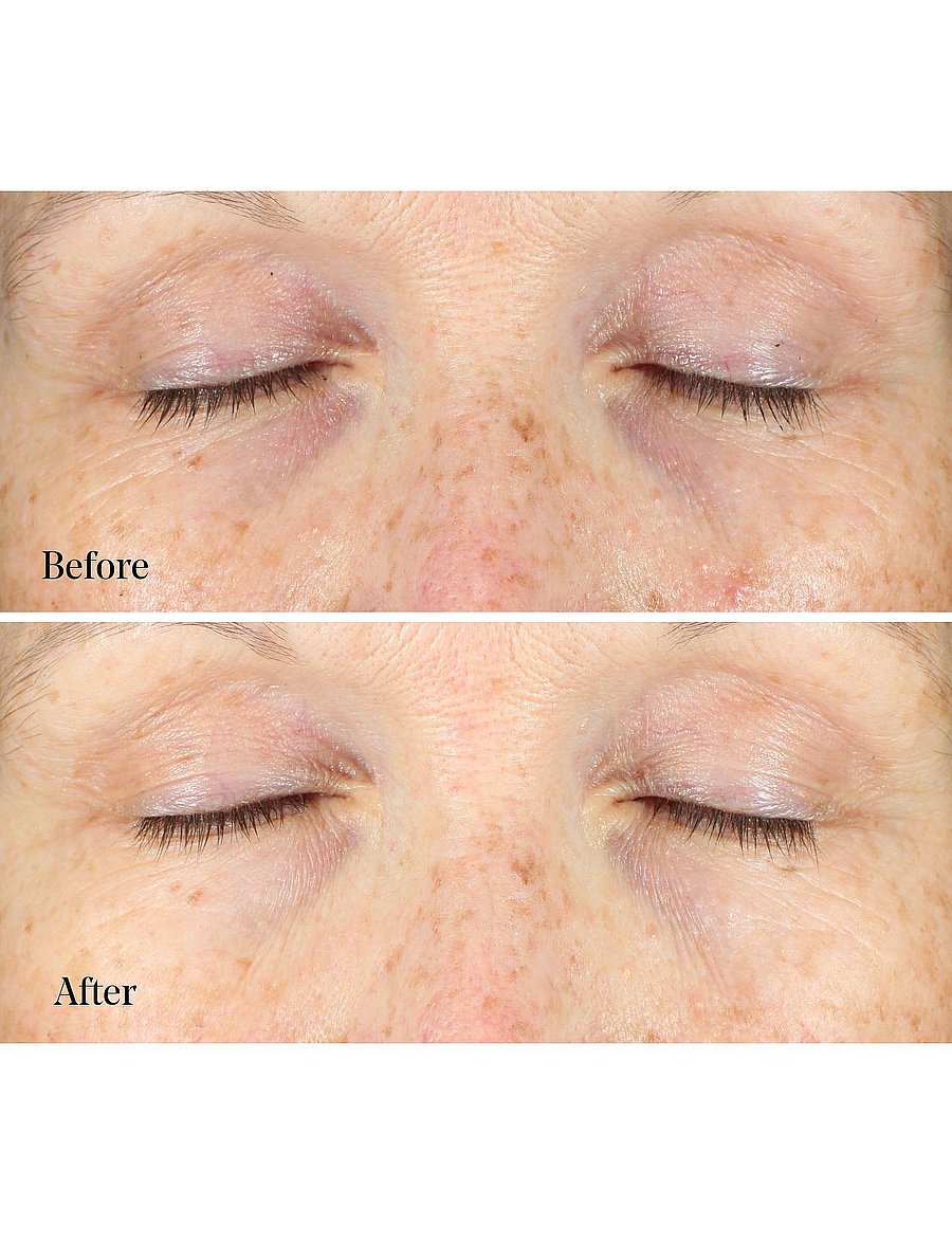 Murad - Vita-C Eyes Dark Circle Corrector - silmakreem - orance - 3