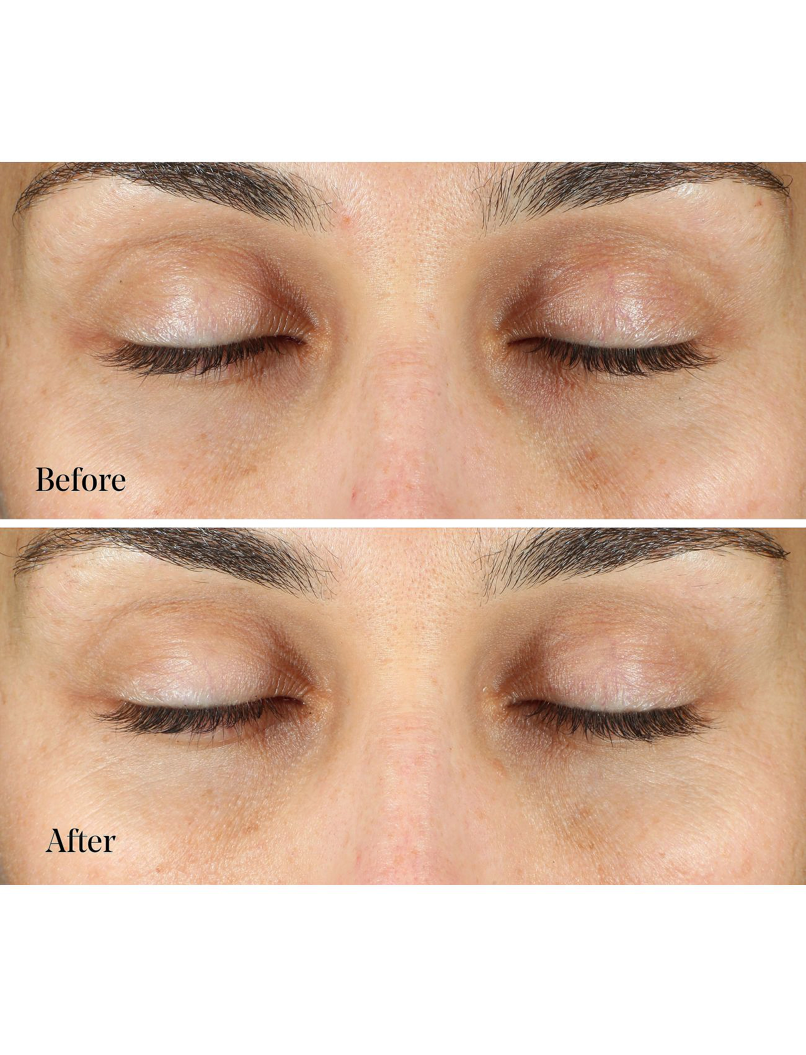 Murad - Vita-C Eyes Dark Circle Corrector - Øjencremer - orance - 4