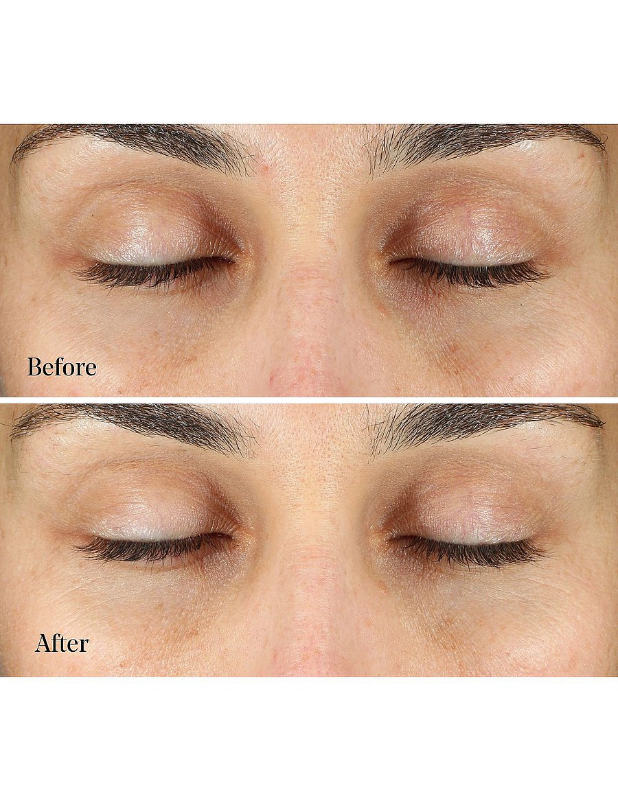 Murad - Vita-C Eyes Dark Circle Corrector - silmakreem - orance - 4