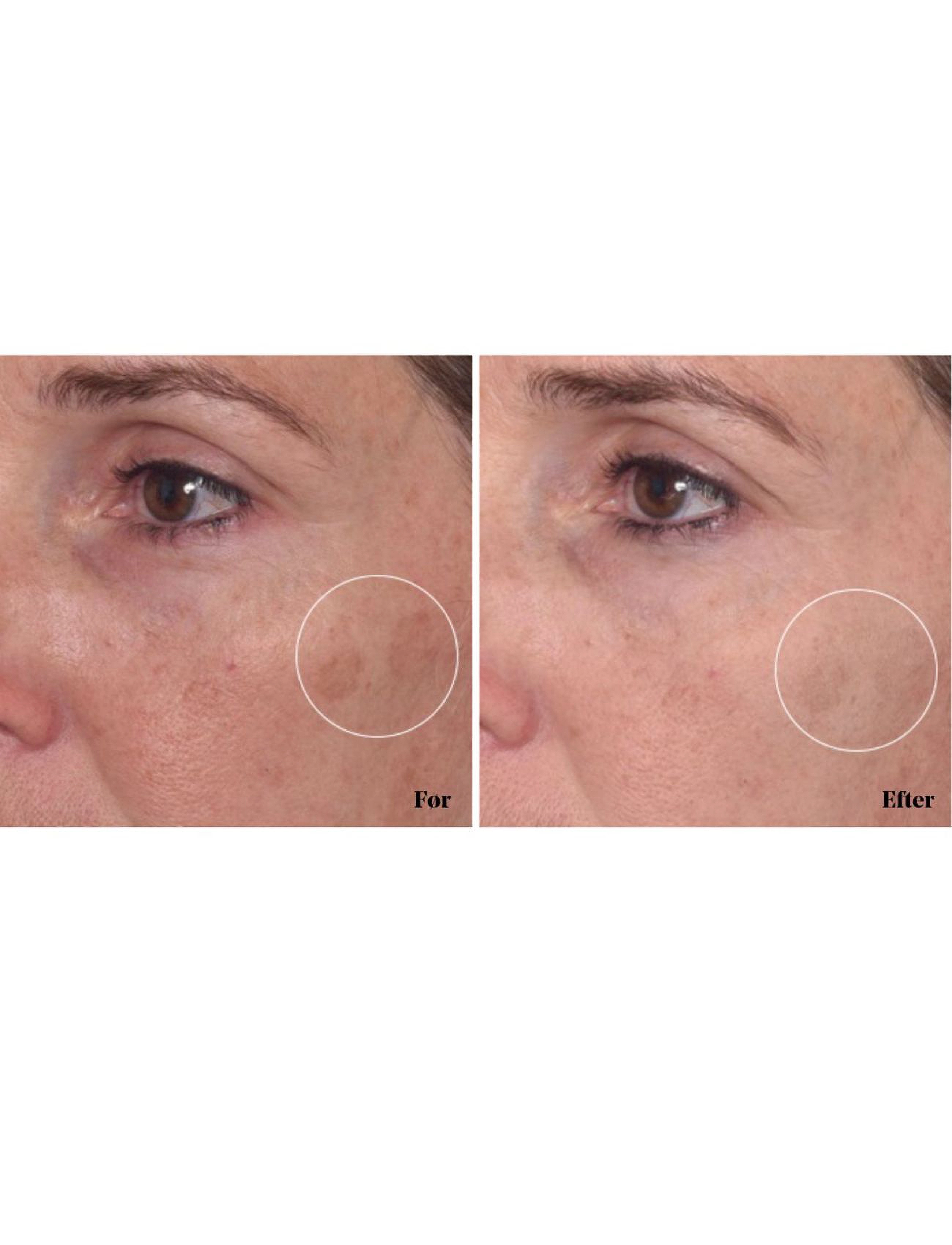 Murad - Rapid Dark Spot Correcting Serum - spotbehandlinger - clear - 4