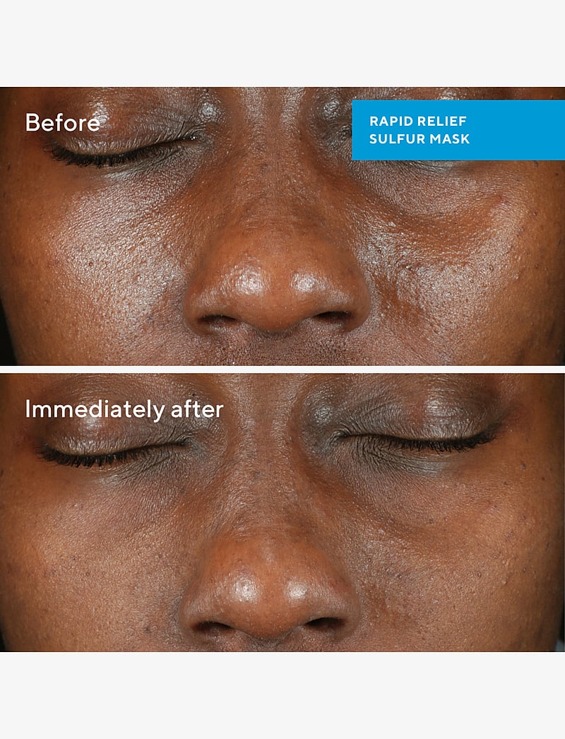 Murad - RAPID RELIEF SULFUR MASK 75 ML - spordihooldusvahendid - clear - 1