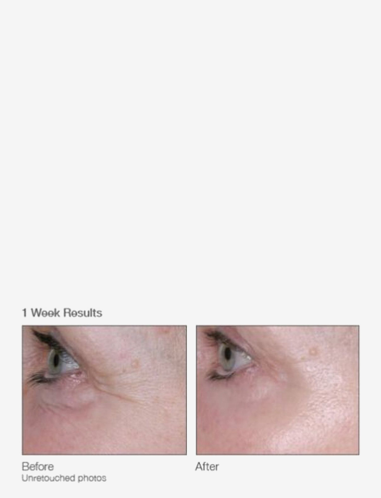 Murad - Renewing Eye Cream - silmänympärysvoide - clear - 1
