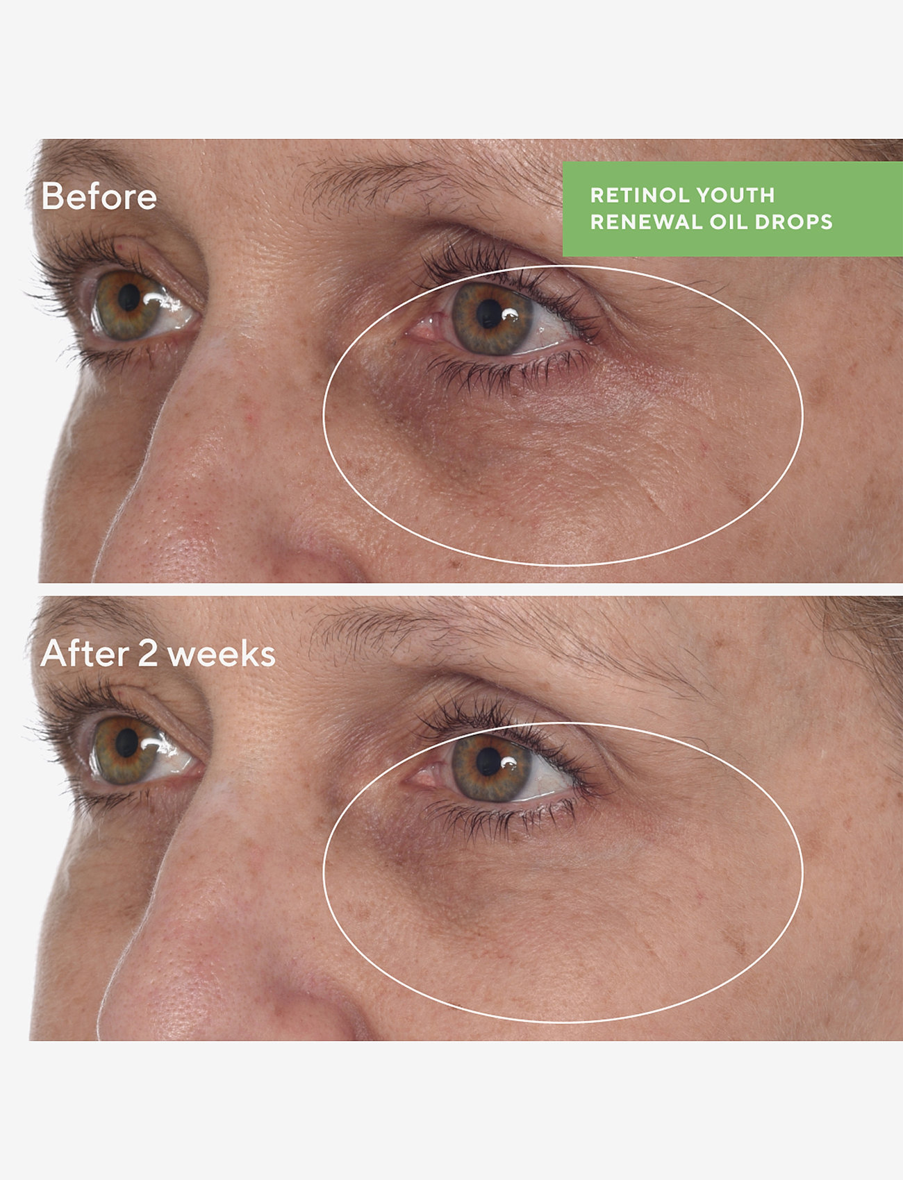 Murad - RETINOL YOUTH RENEWAL OIL DROPS 30 ML - ansigtsolier - clear - 5