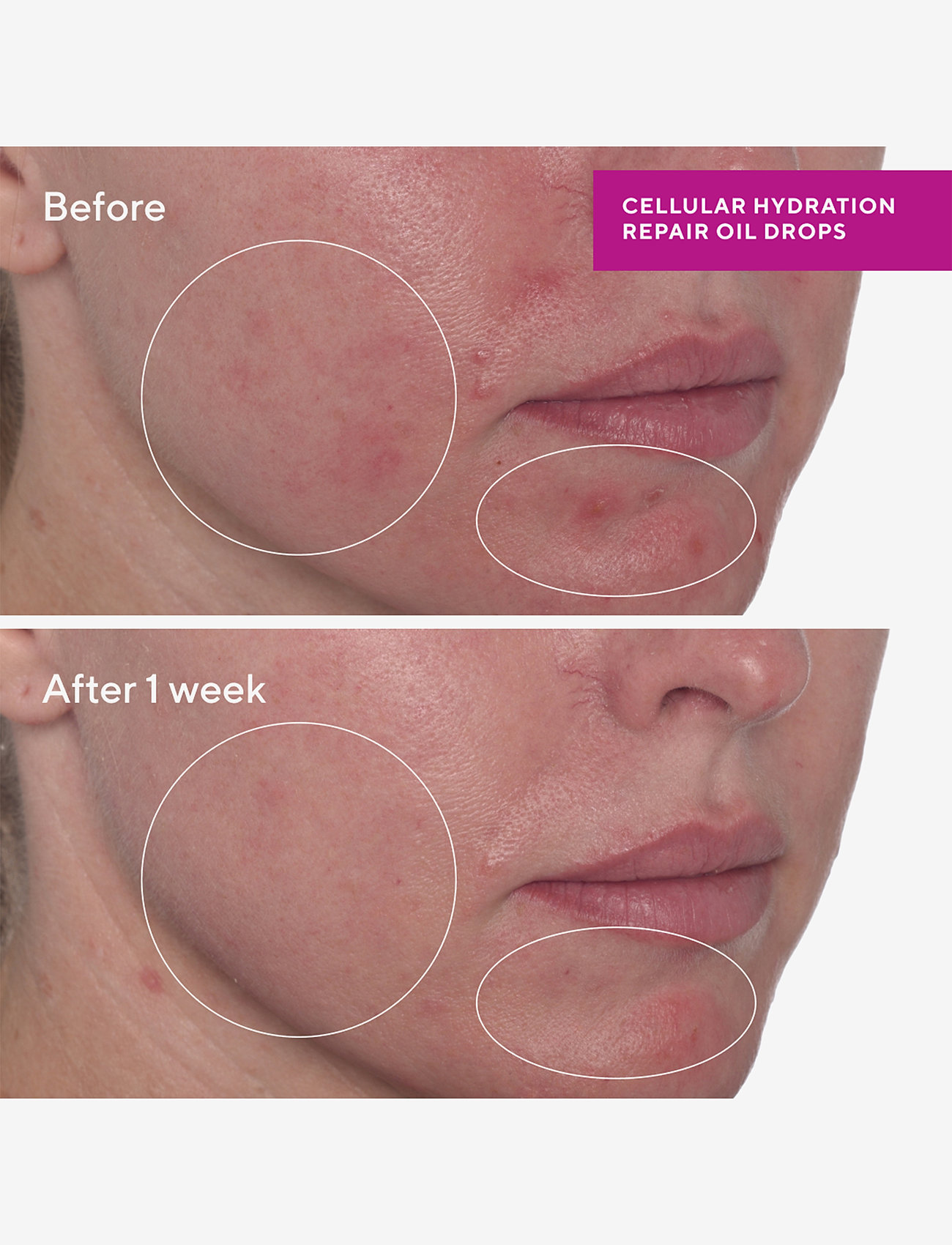 Murad - CELLULAR HYDRATION REPAIR OIL DROPS 30 ML - ansigtsolier - clear - 4