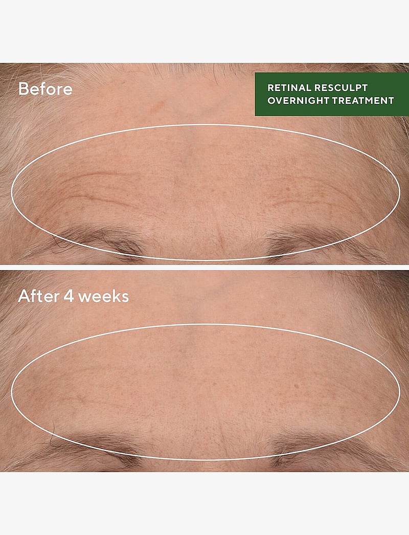 Murad - Retinal ReSculpt Overnight Treatment - serums - clear - 2