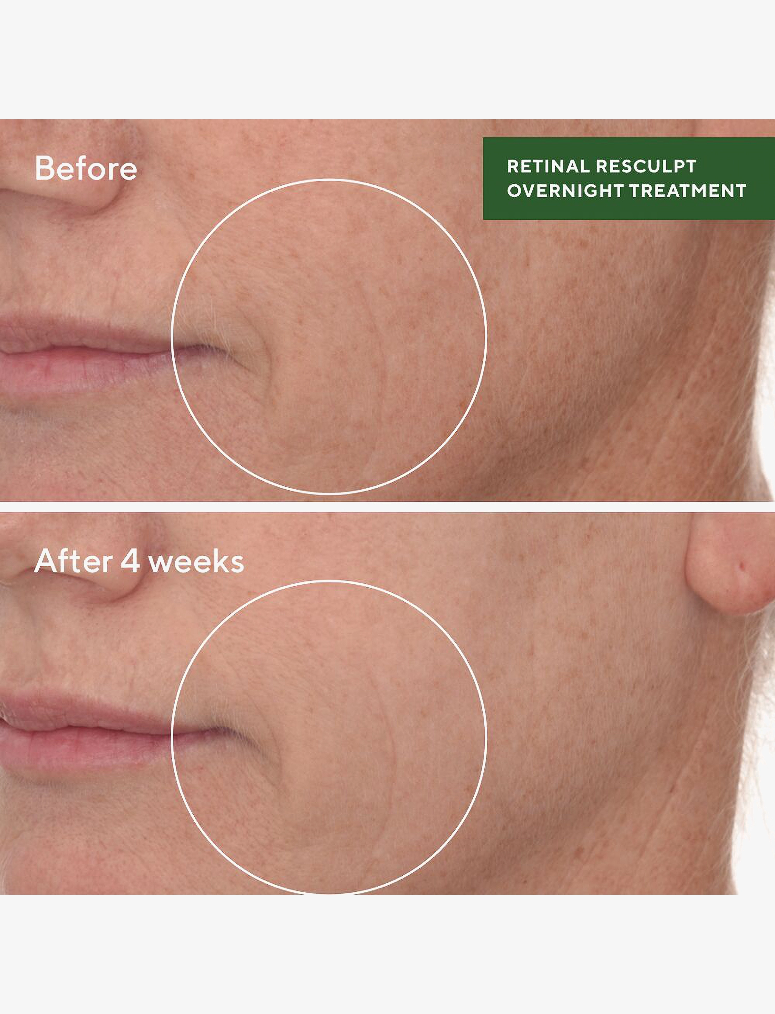 Murad - Retinal ReSculpt Overnight Treatment - serum - clear - 4